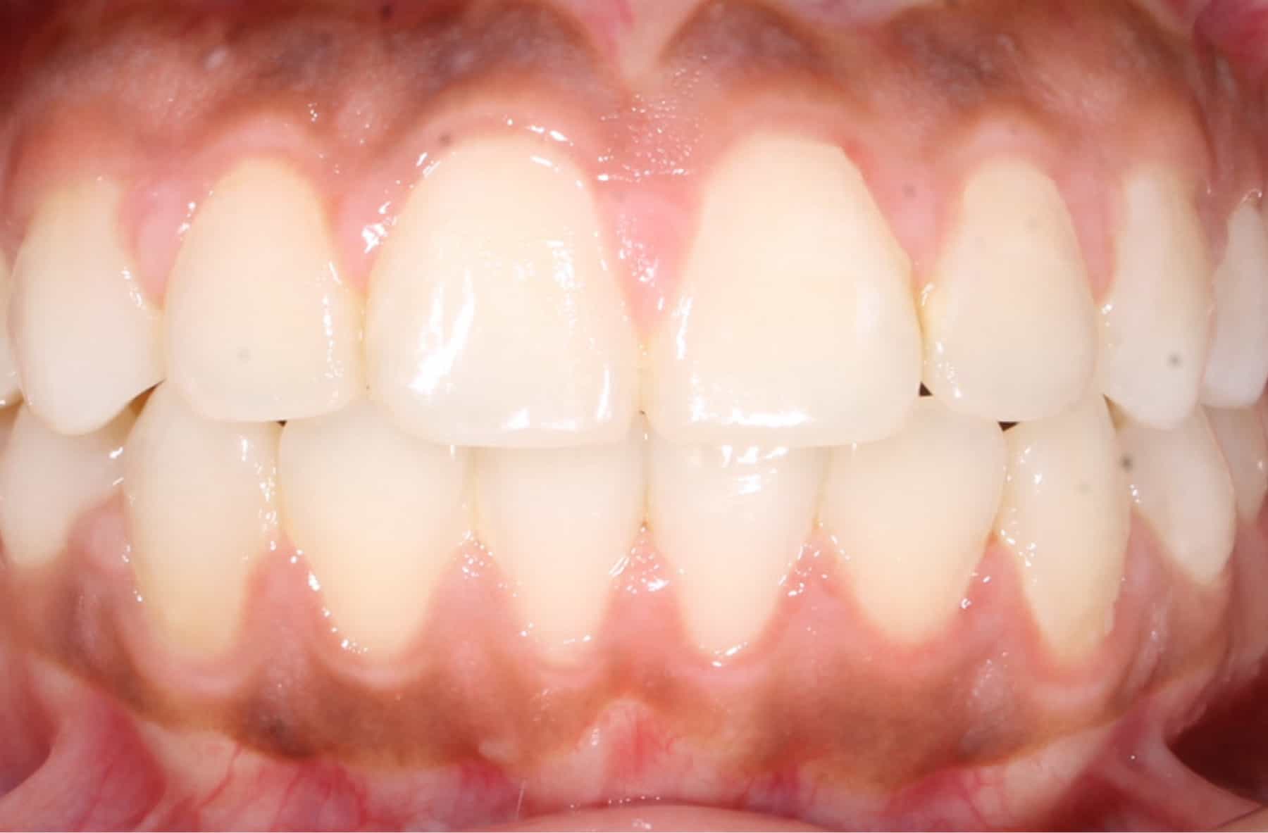 after Image