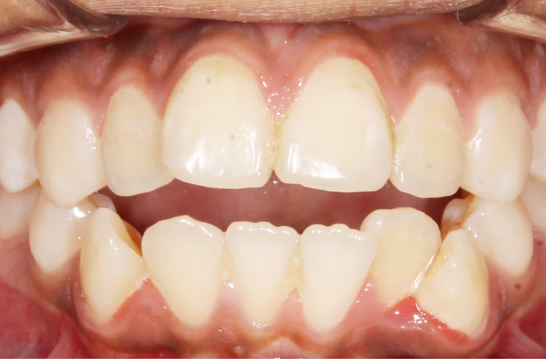 before Image