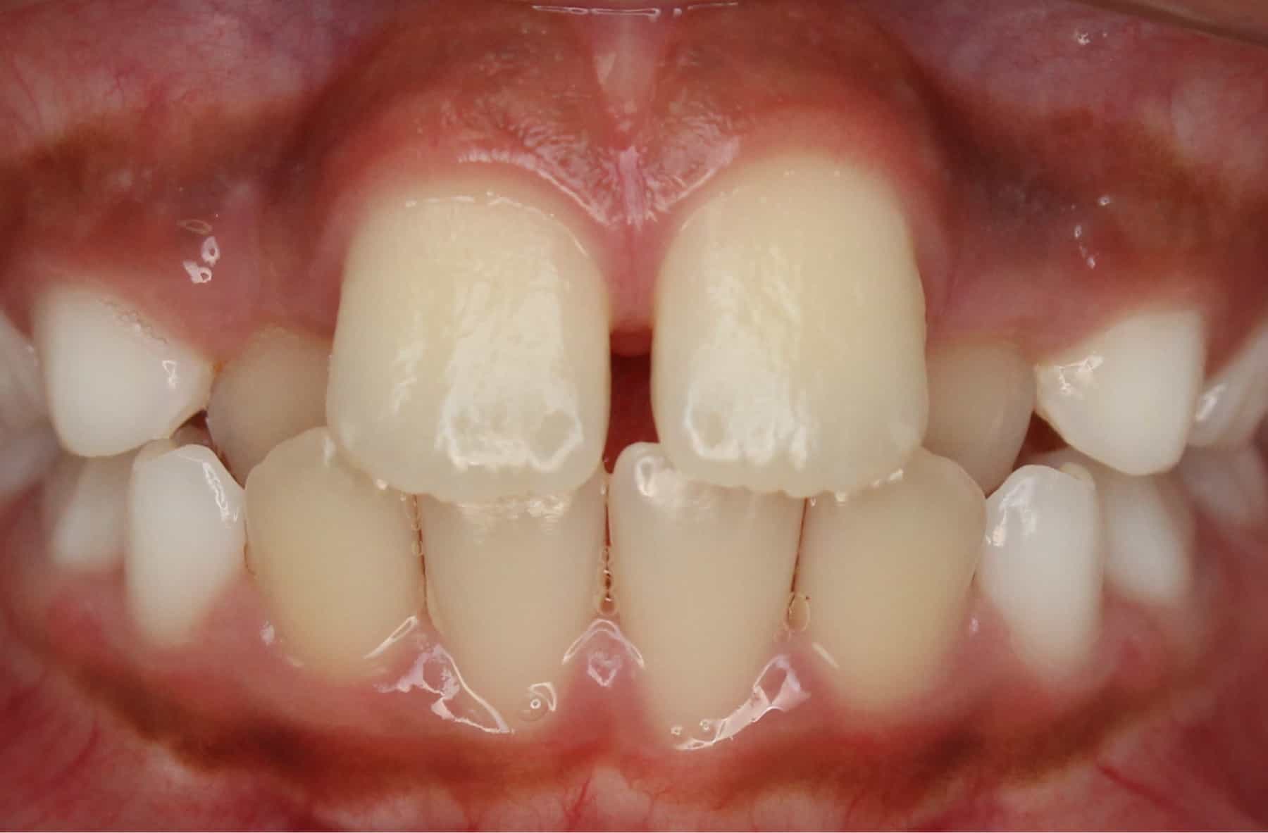 before Image