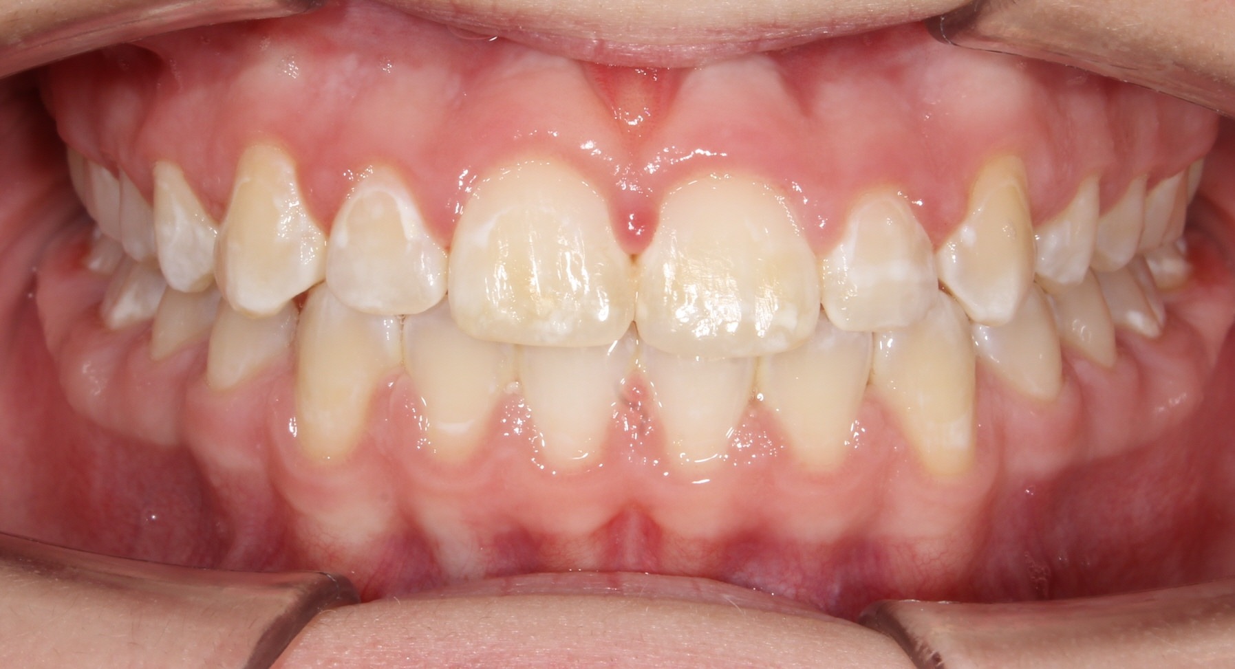 after Image