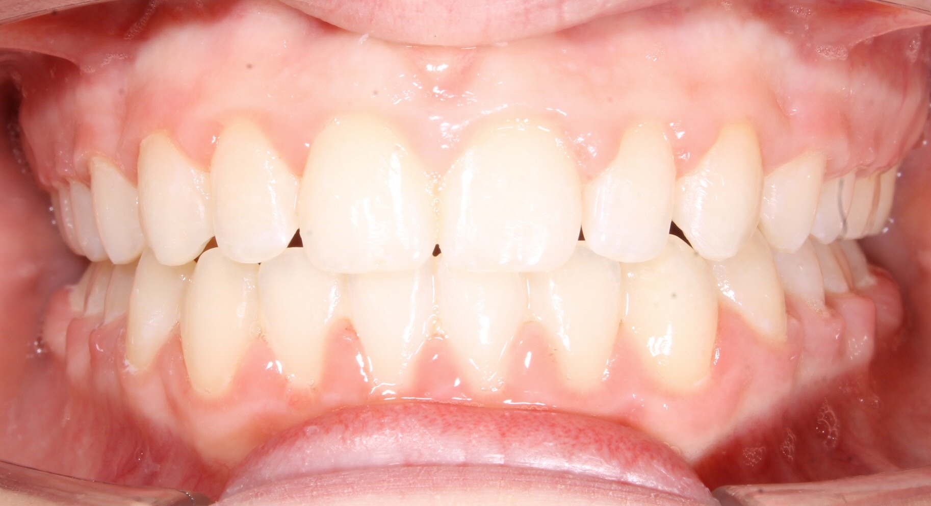 after Image