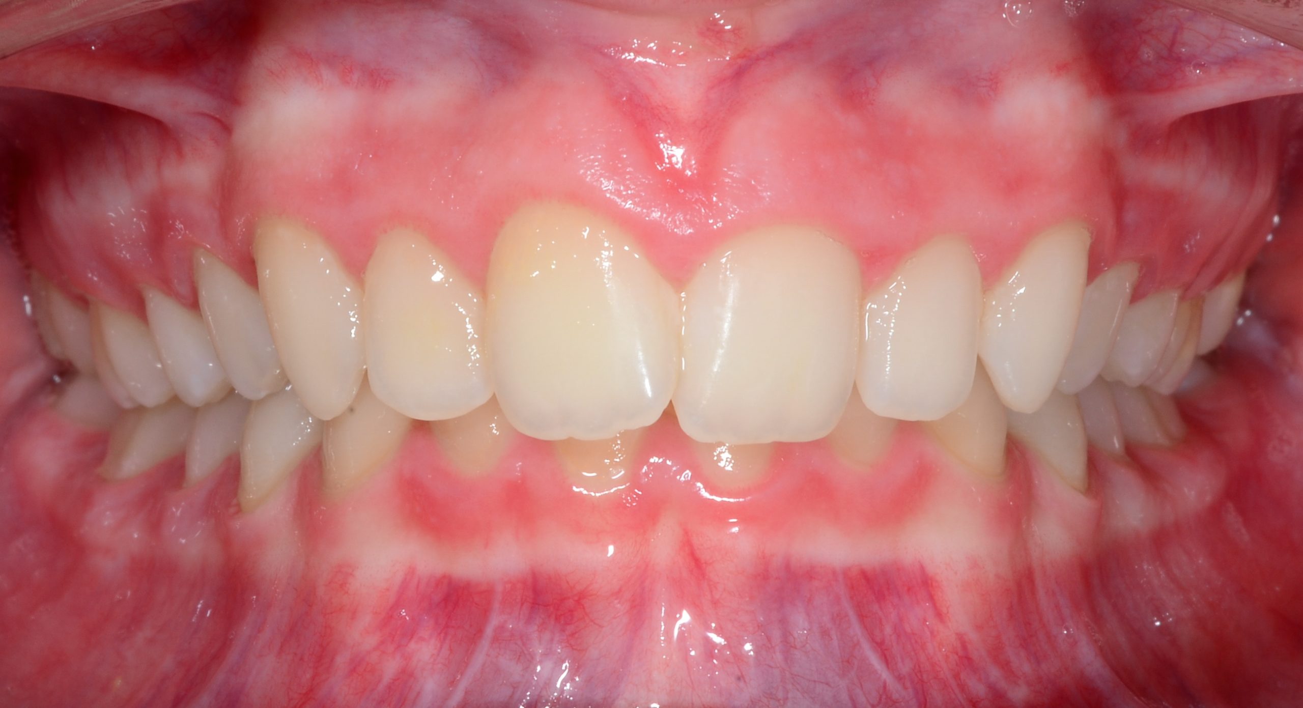 before Image