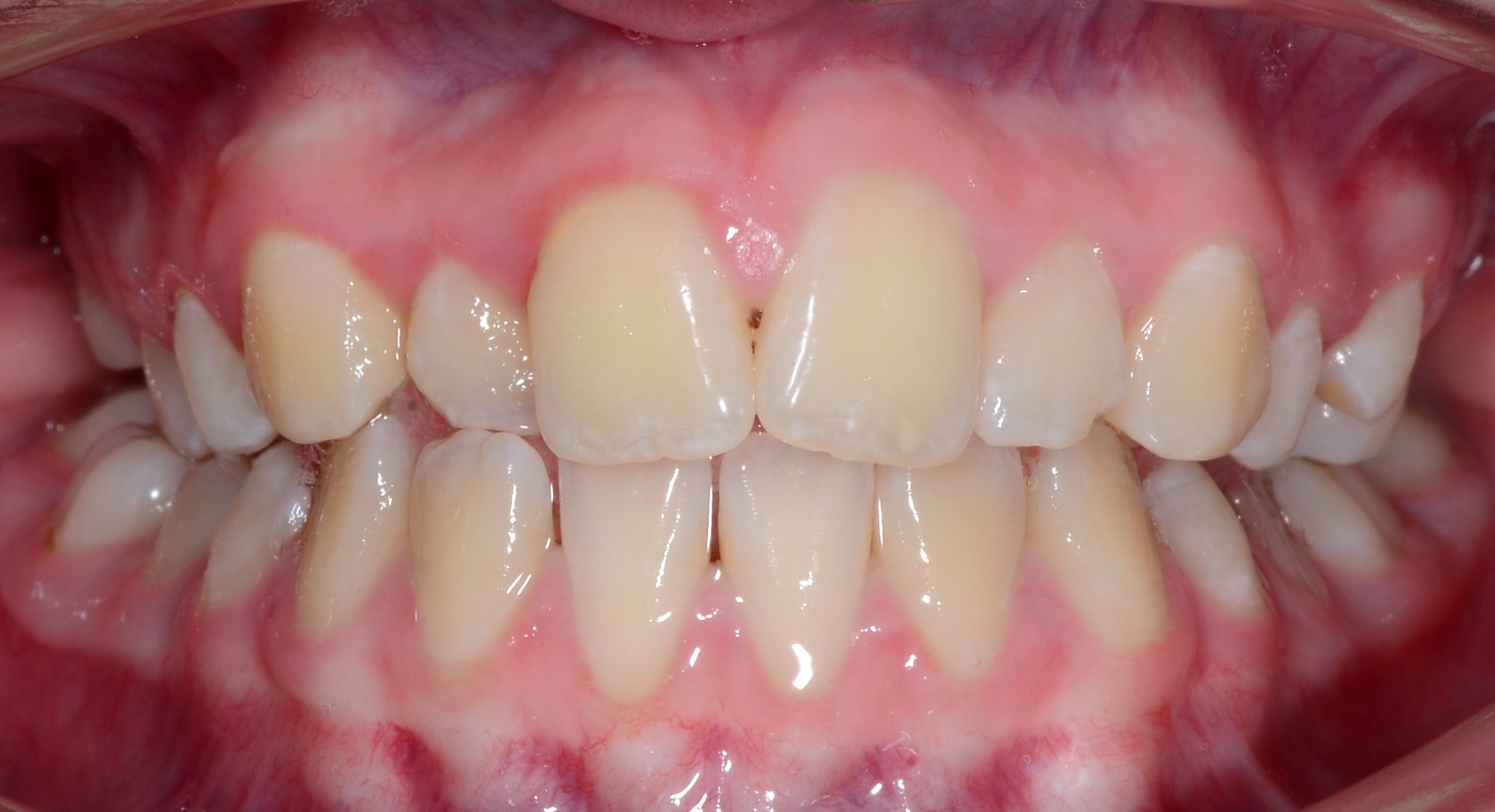 before Image
