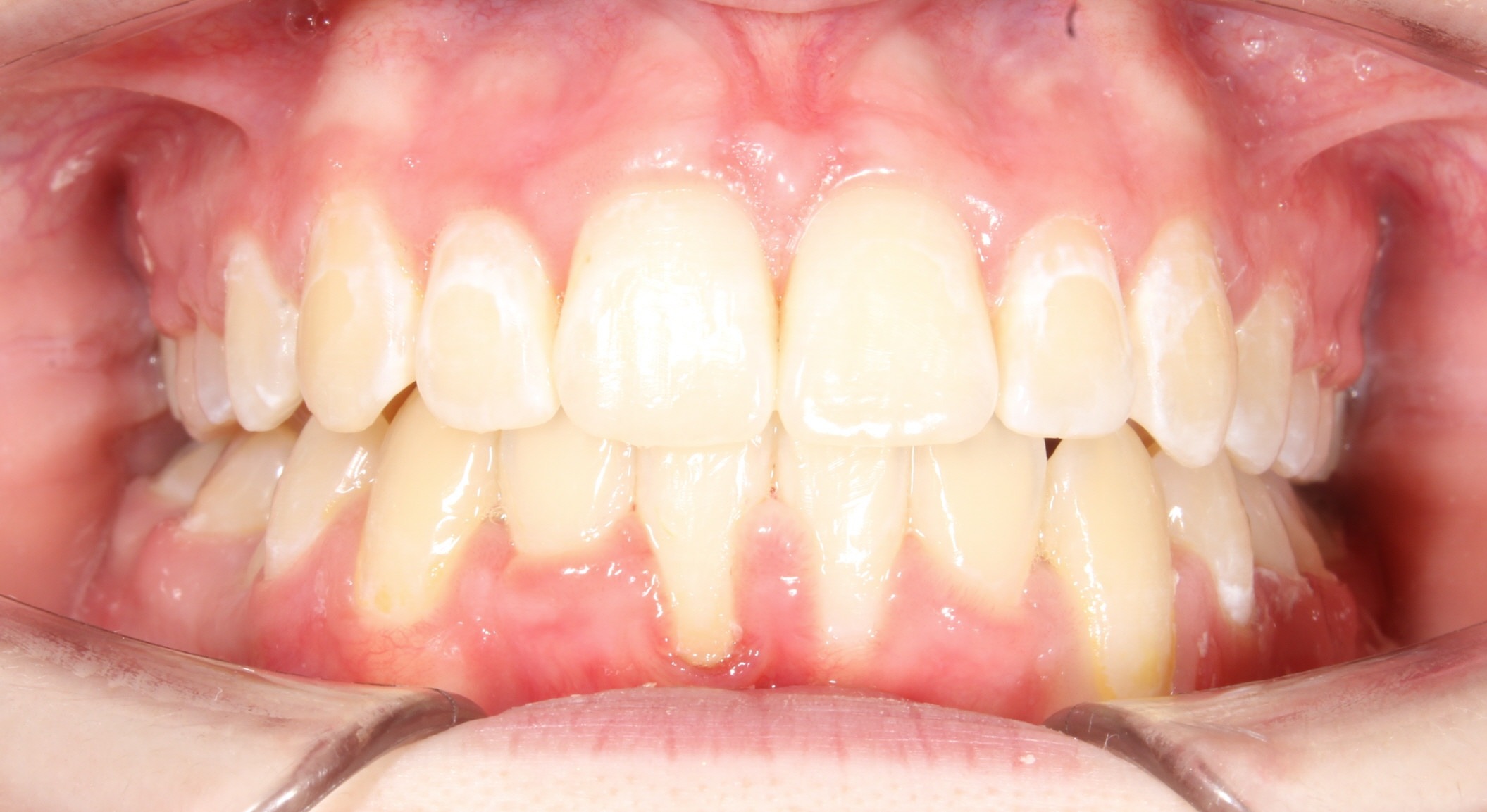 after Image