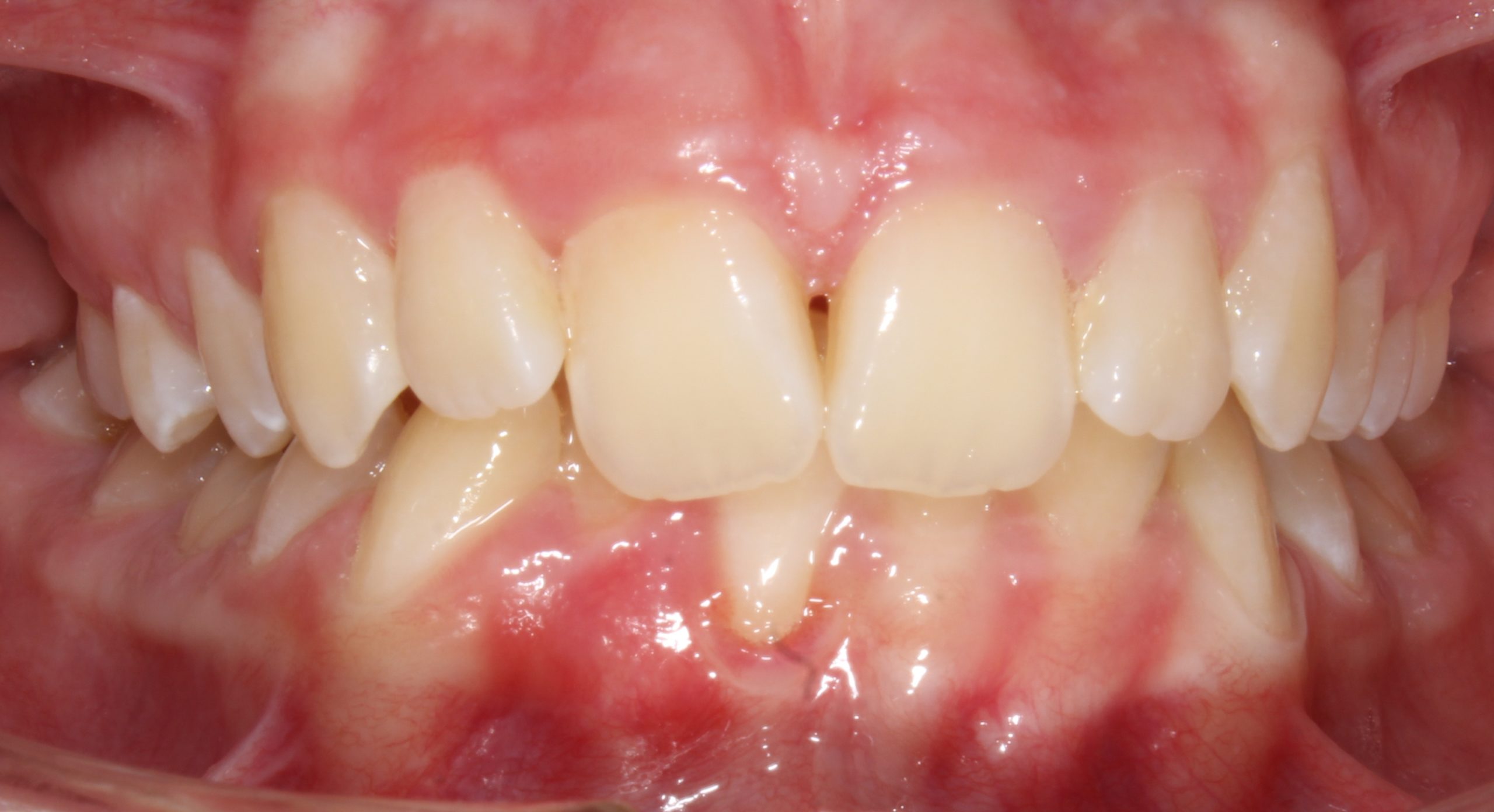 before Image