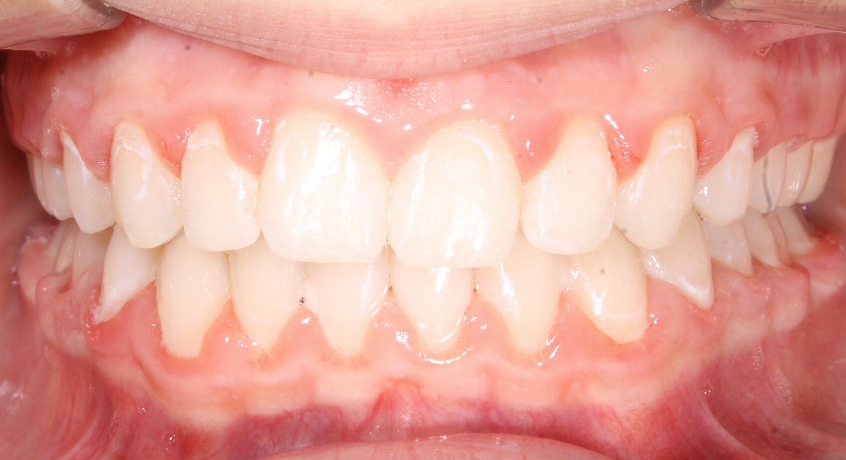 after Image