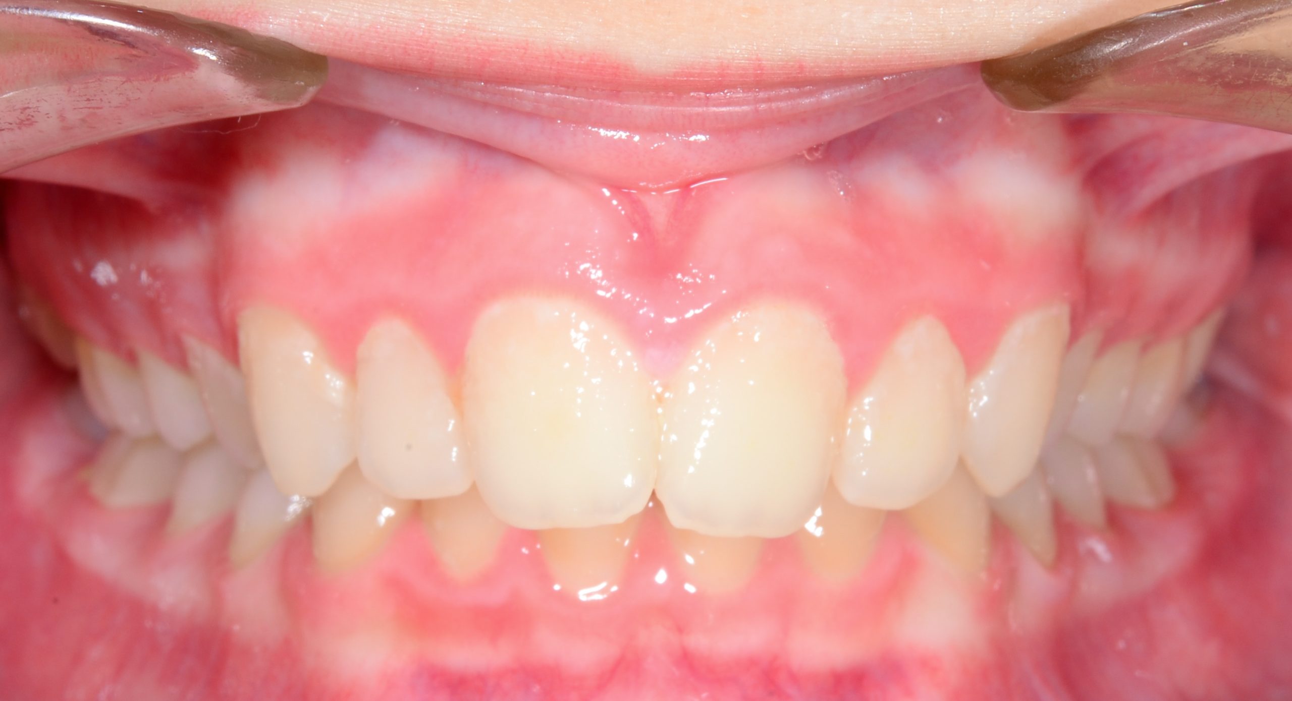 before Image