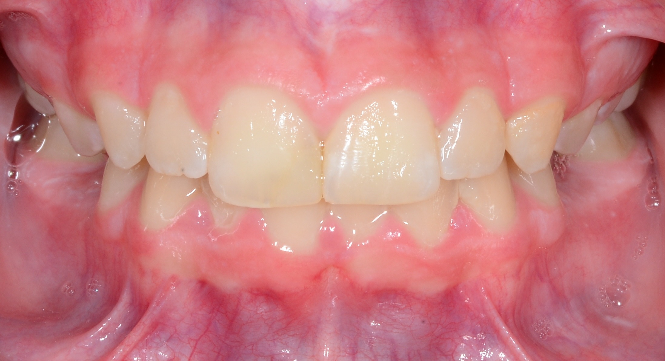 before Image