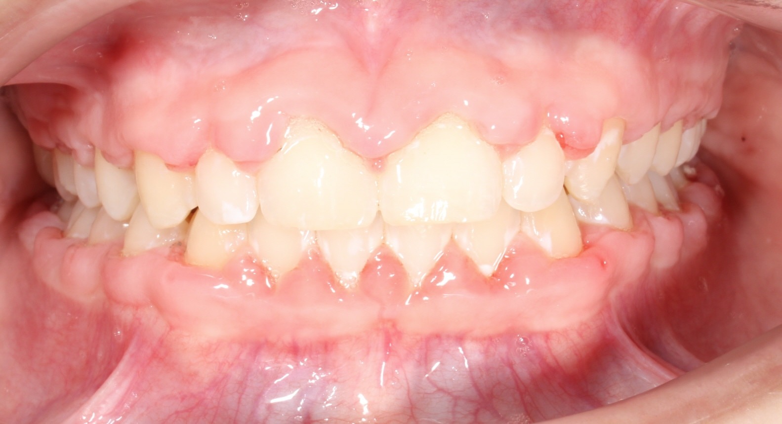 after Image