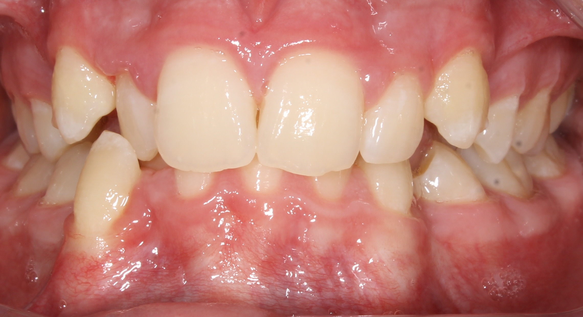 before Image