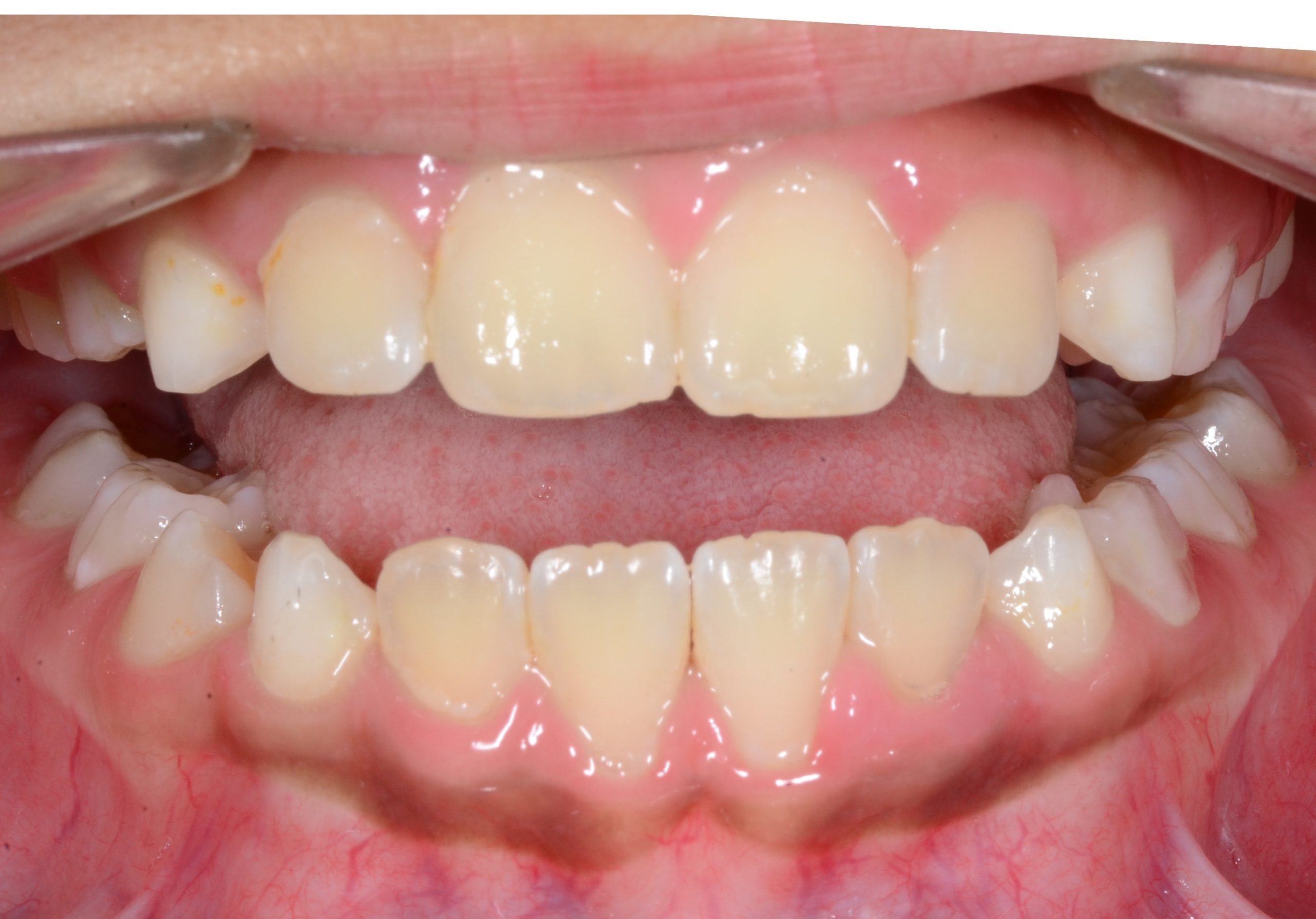 after Image