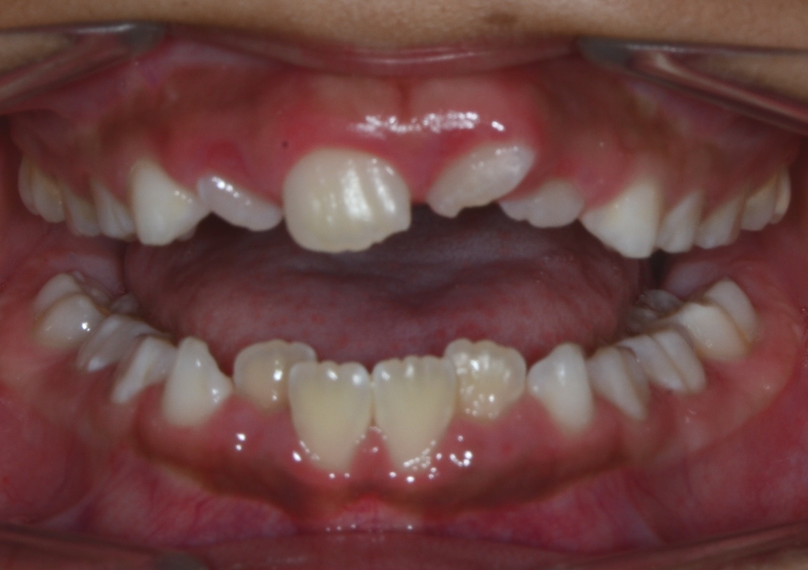 before Image