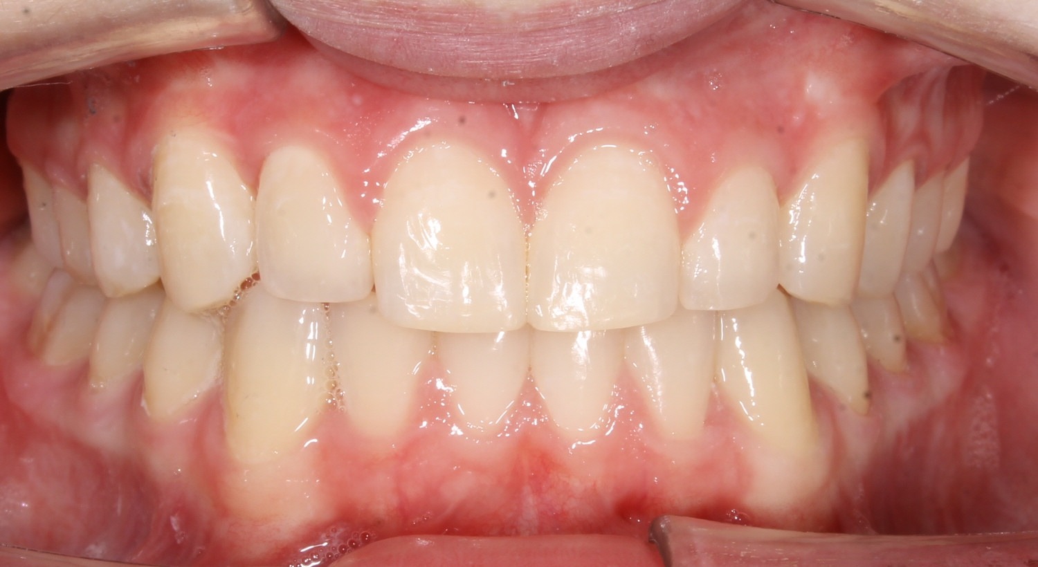 after Image
