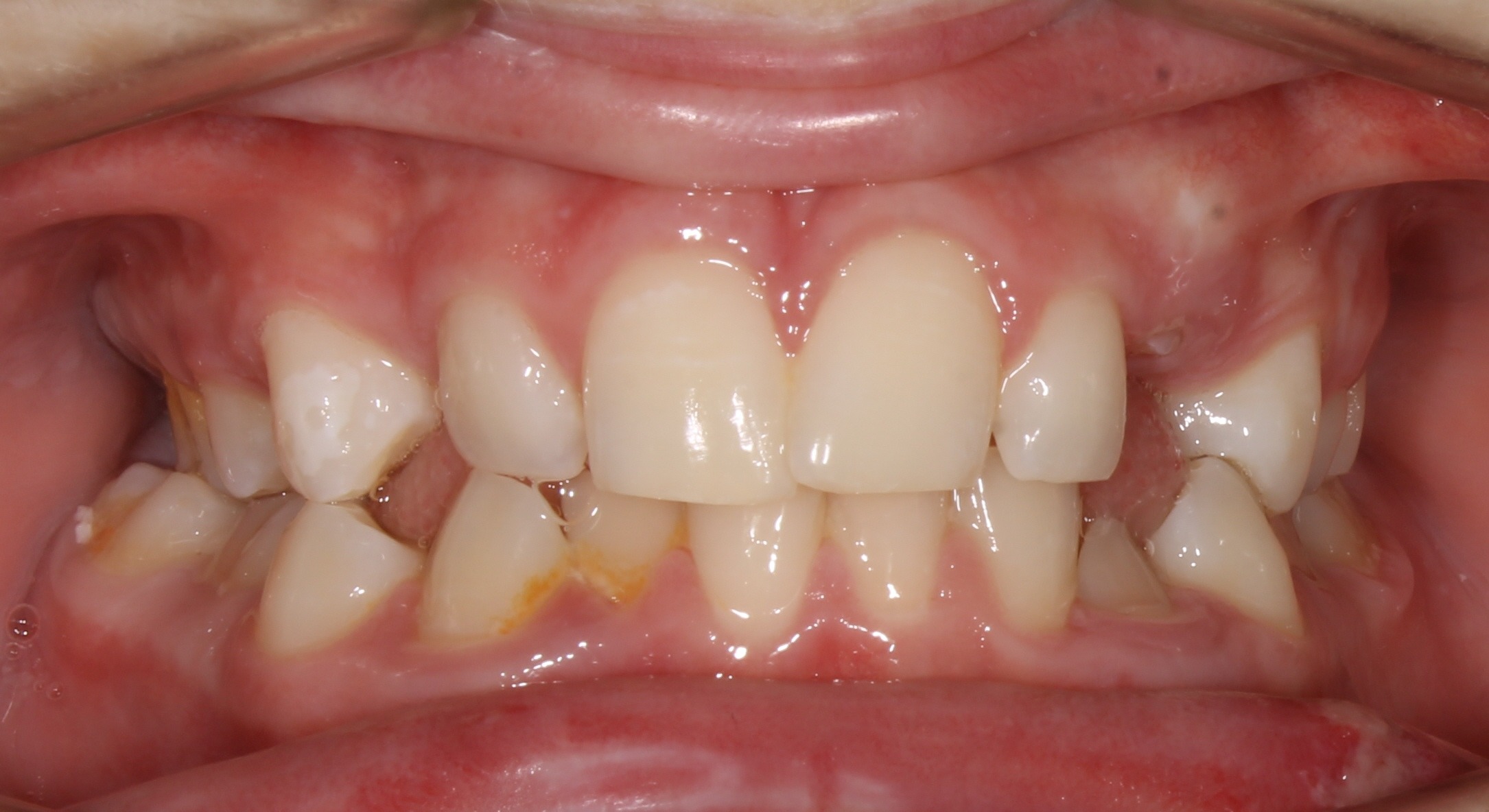 before Image