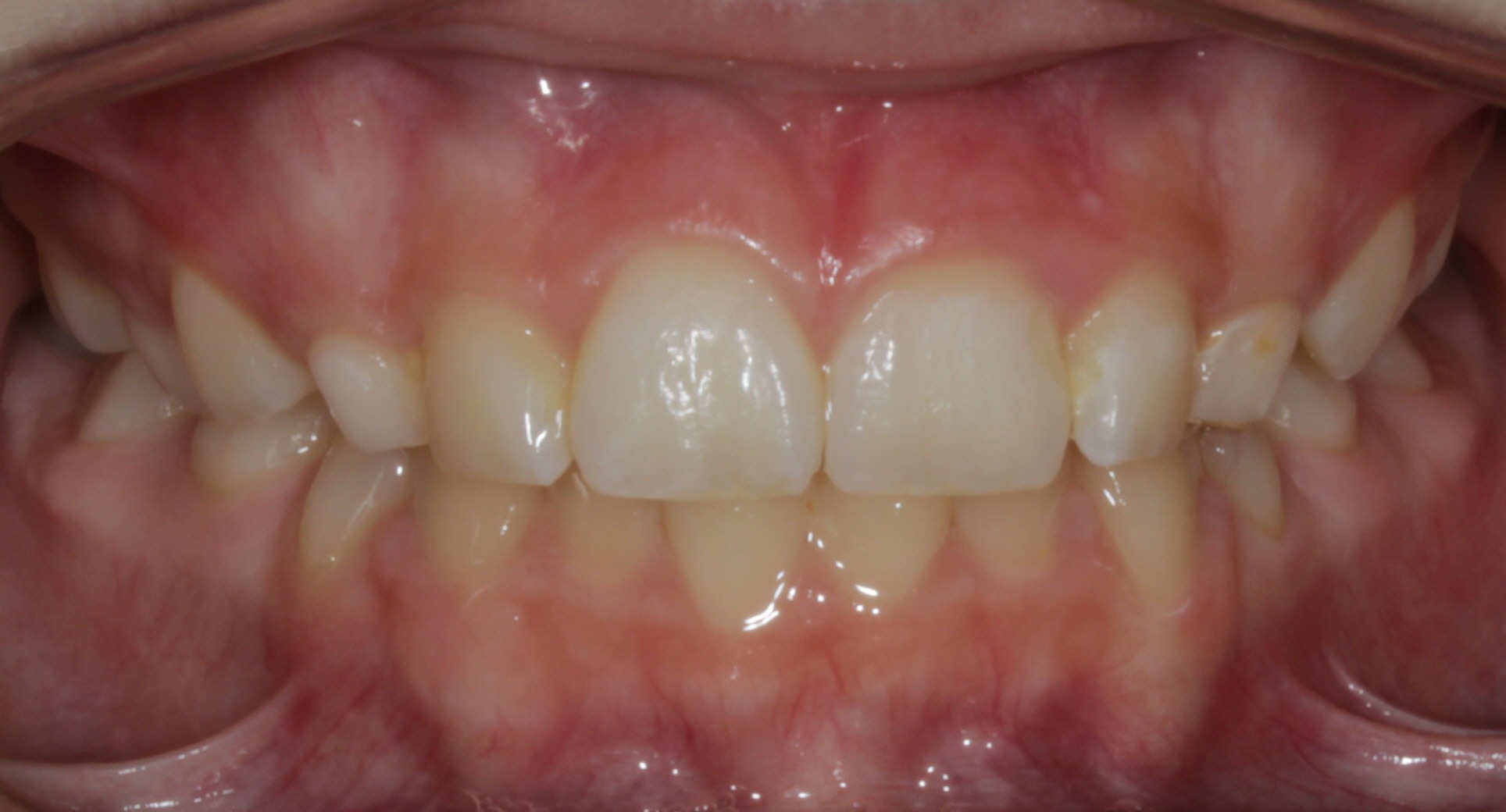 after Image