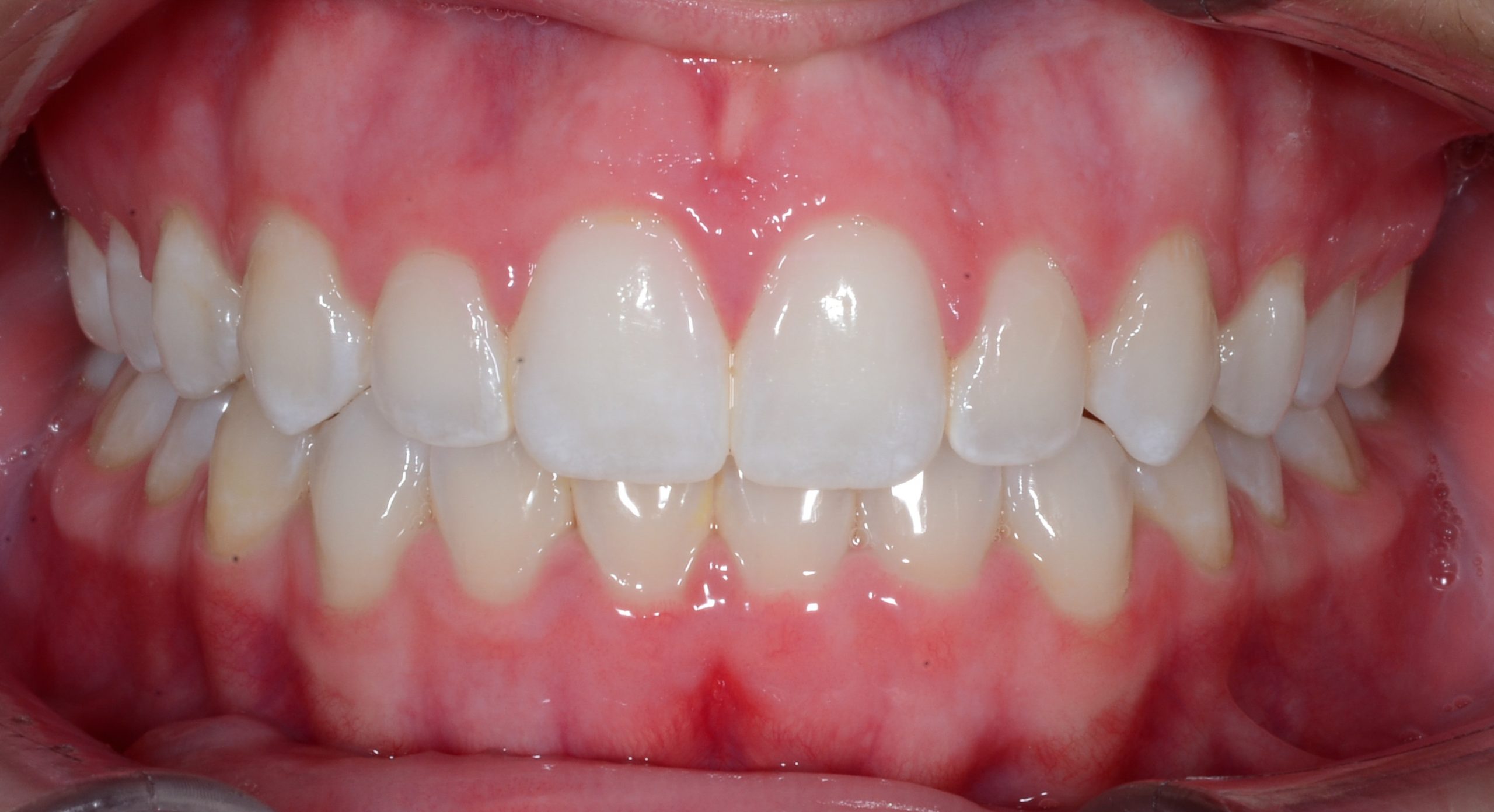 after Image