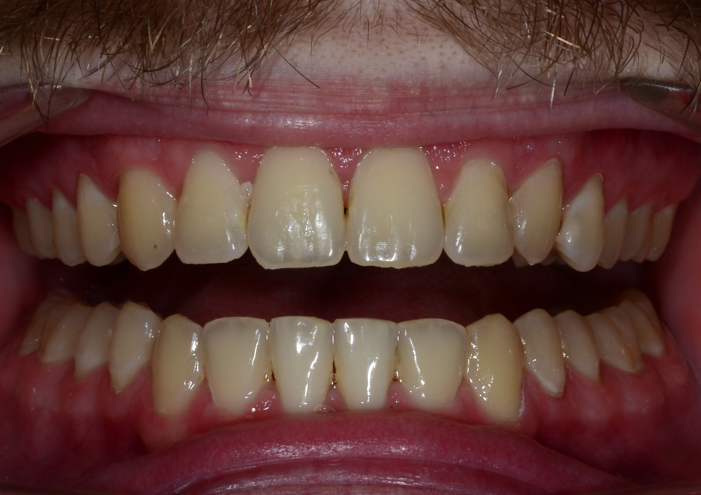 after Image
