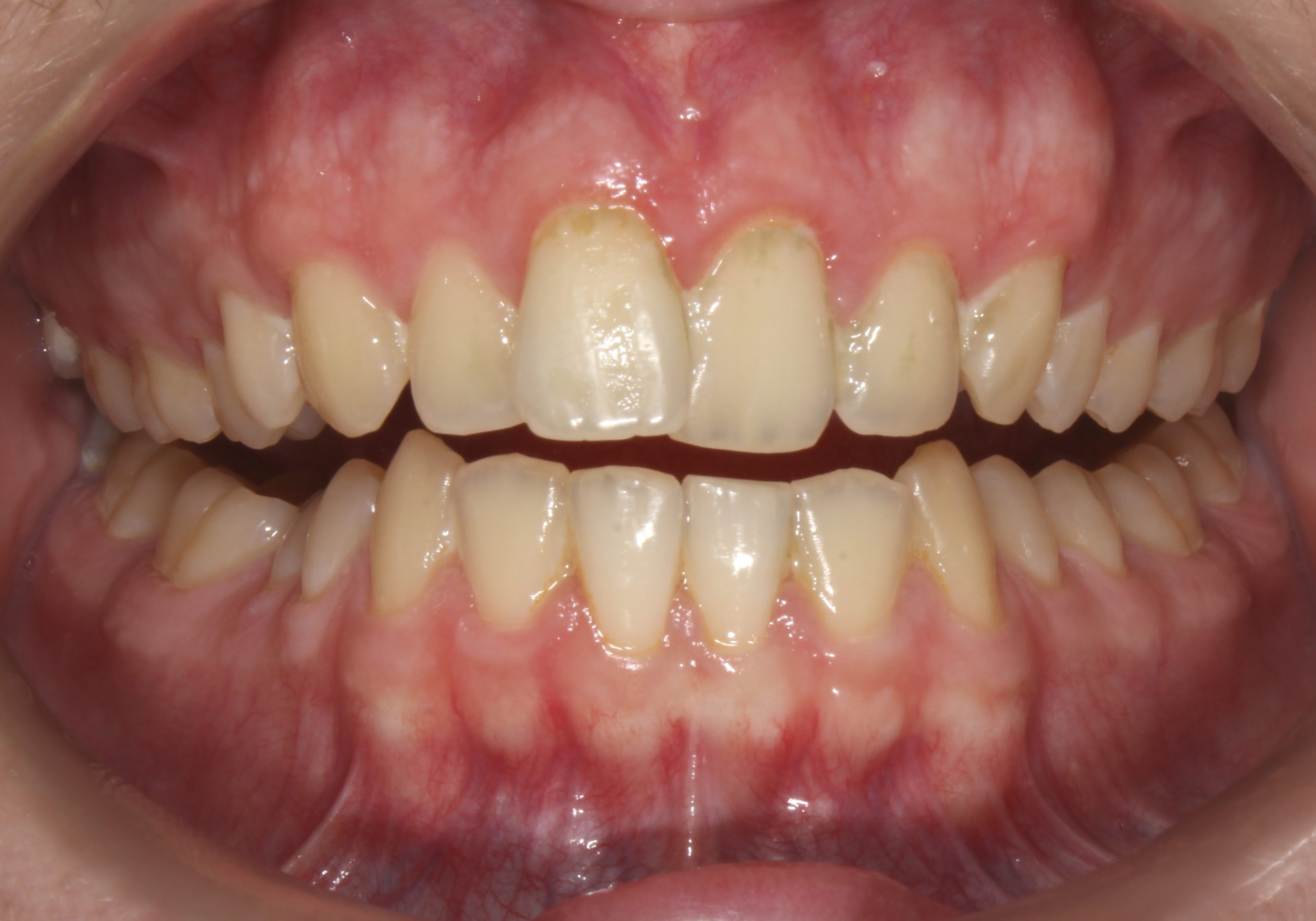 before Image