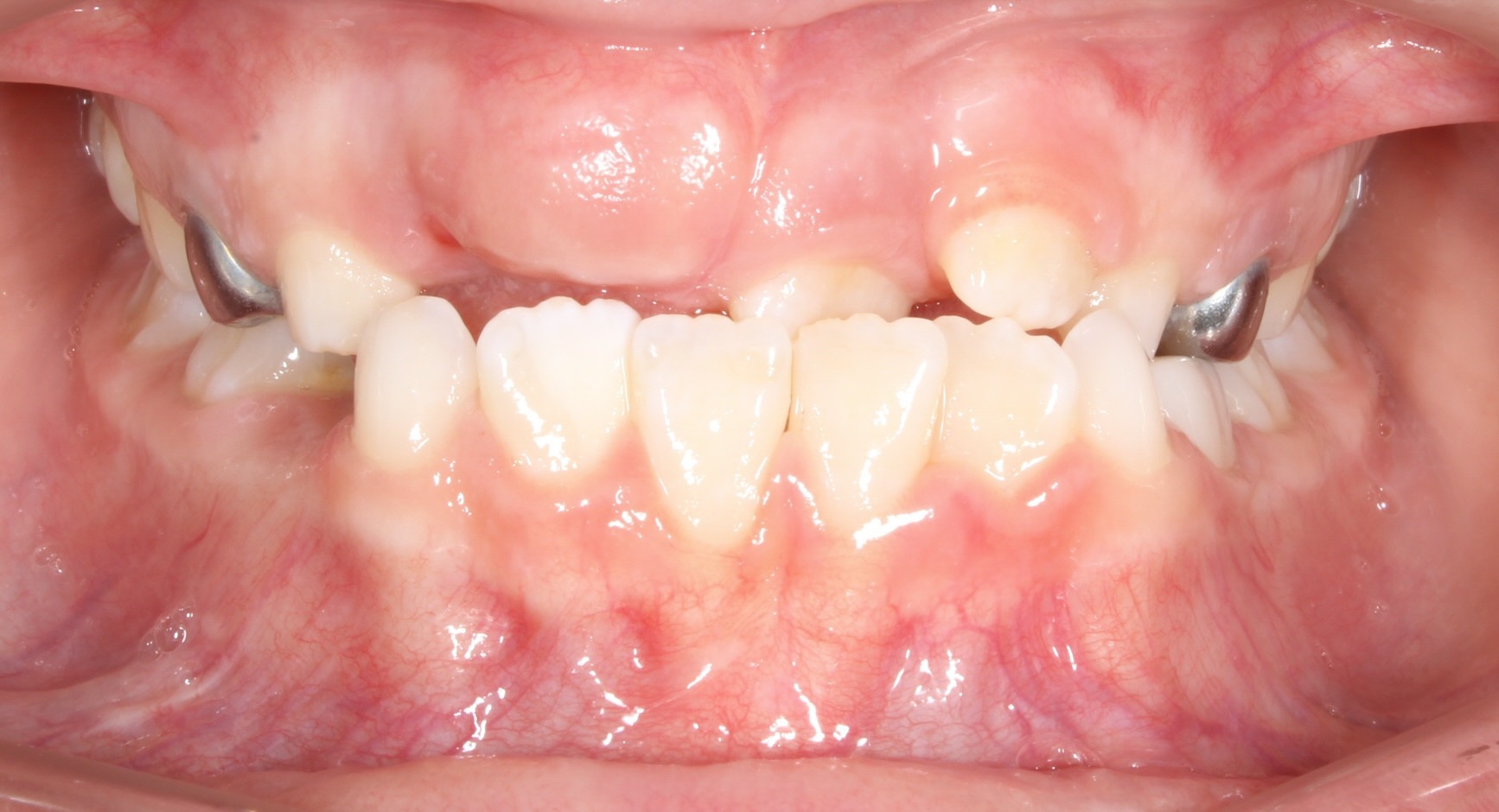 before Image