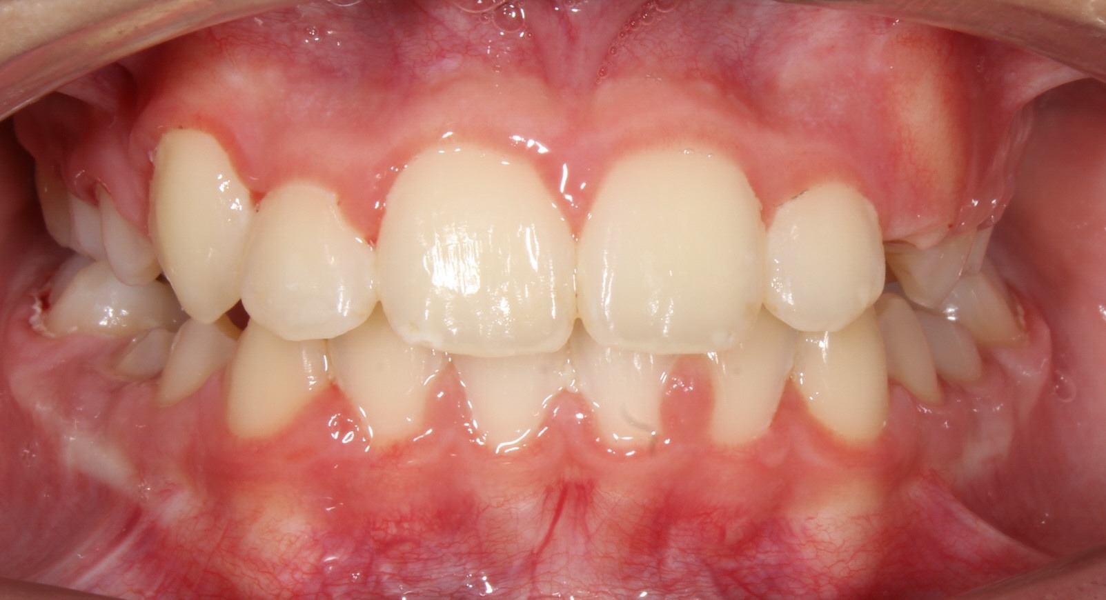 after Image