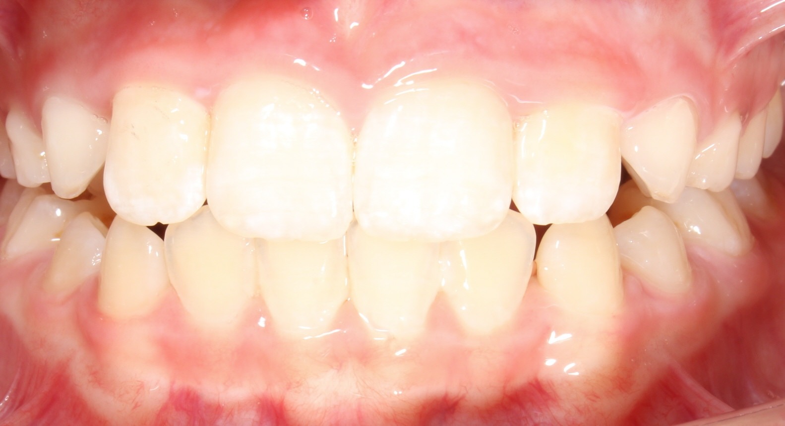 after Image