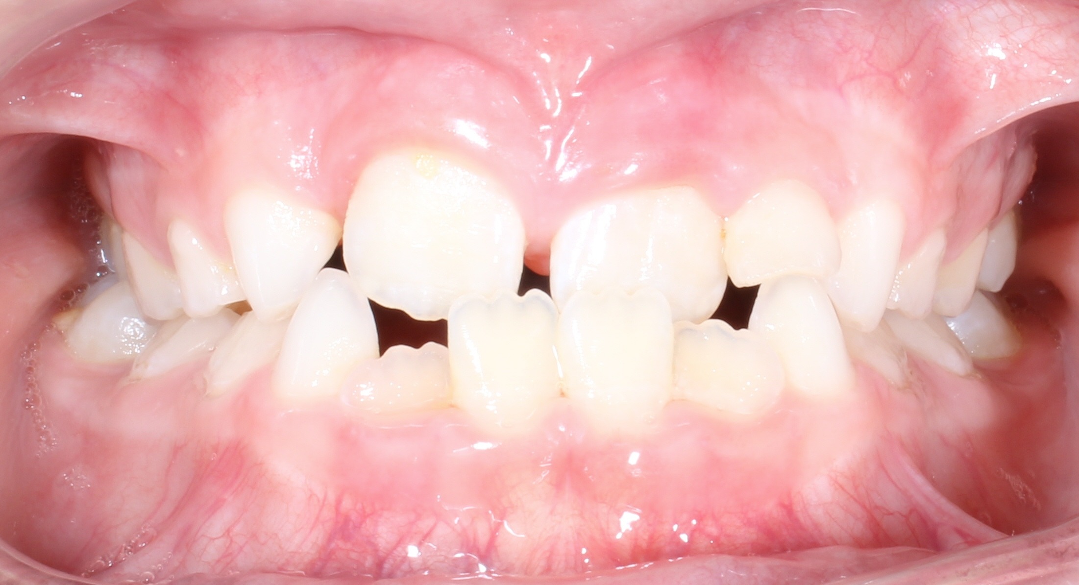before Image