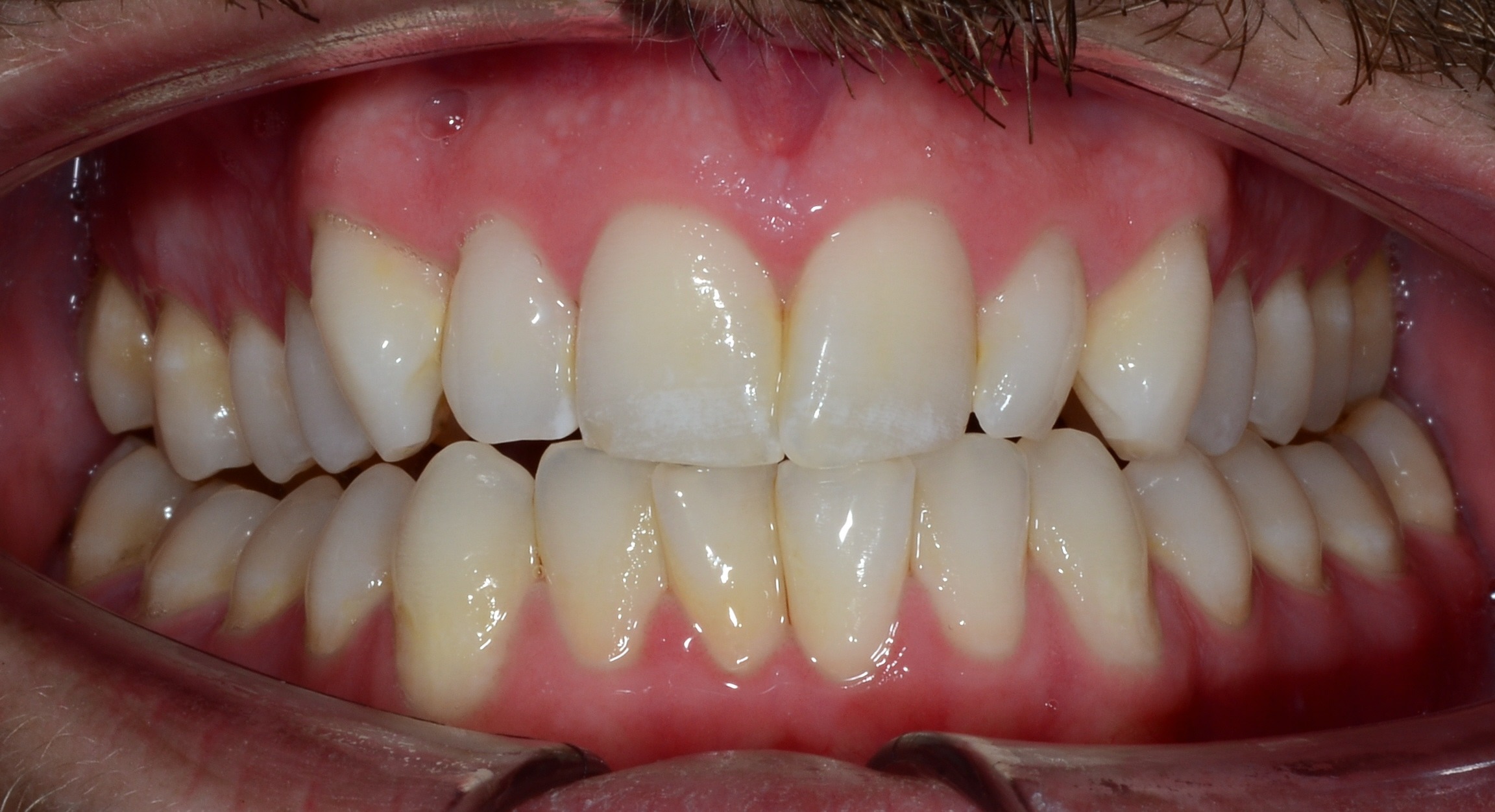 before Image