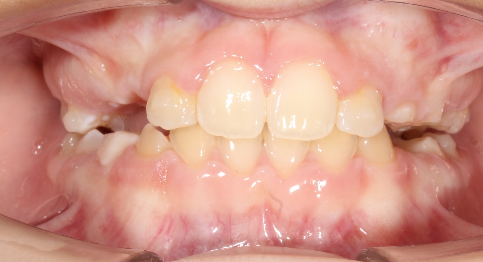 after Image