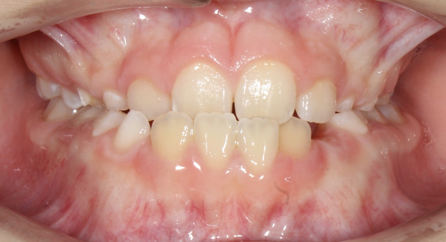 before Image