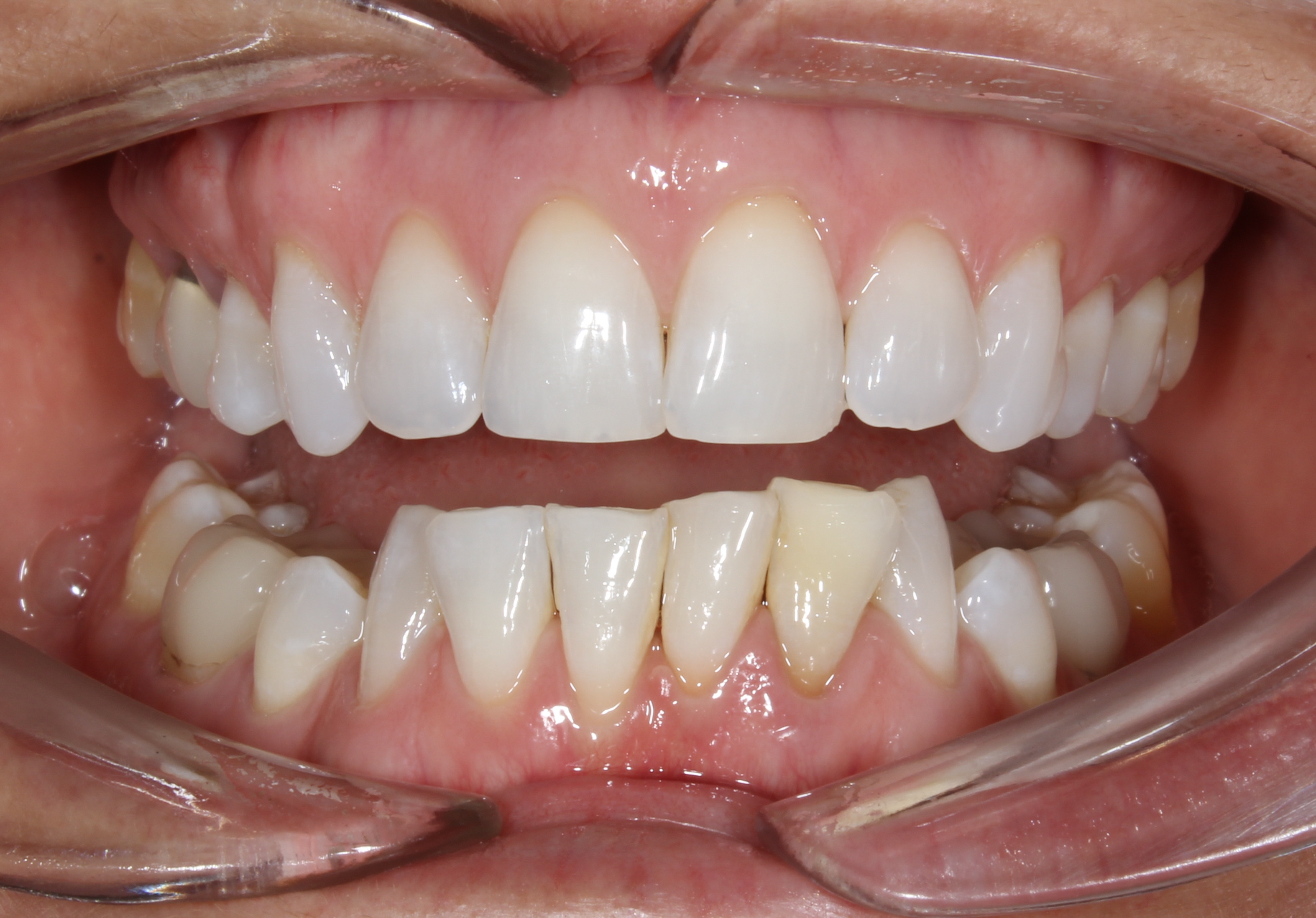 before Image