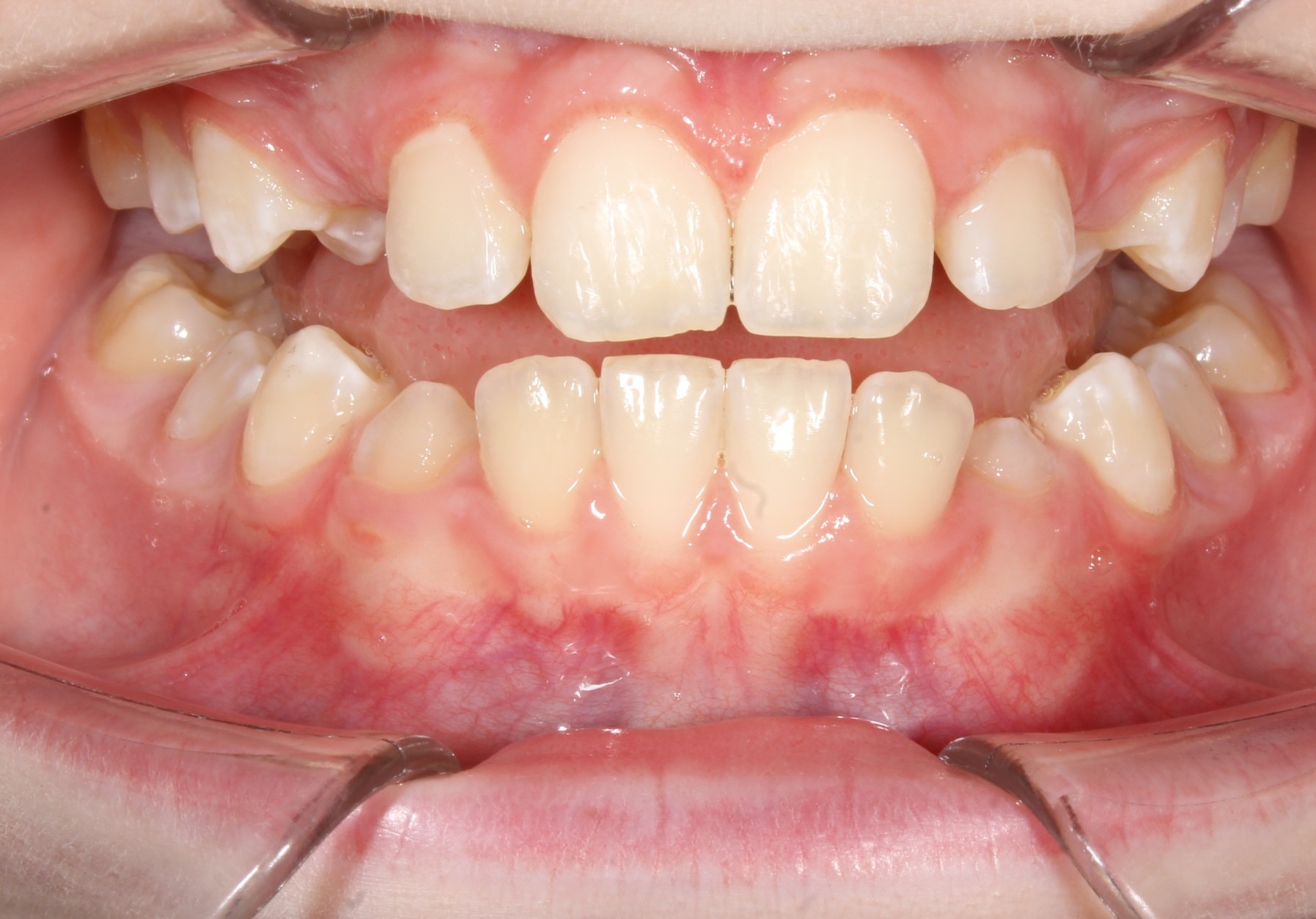 after Image