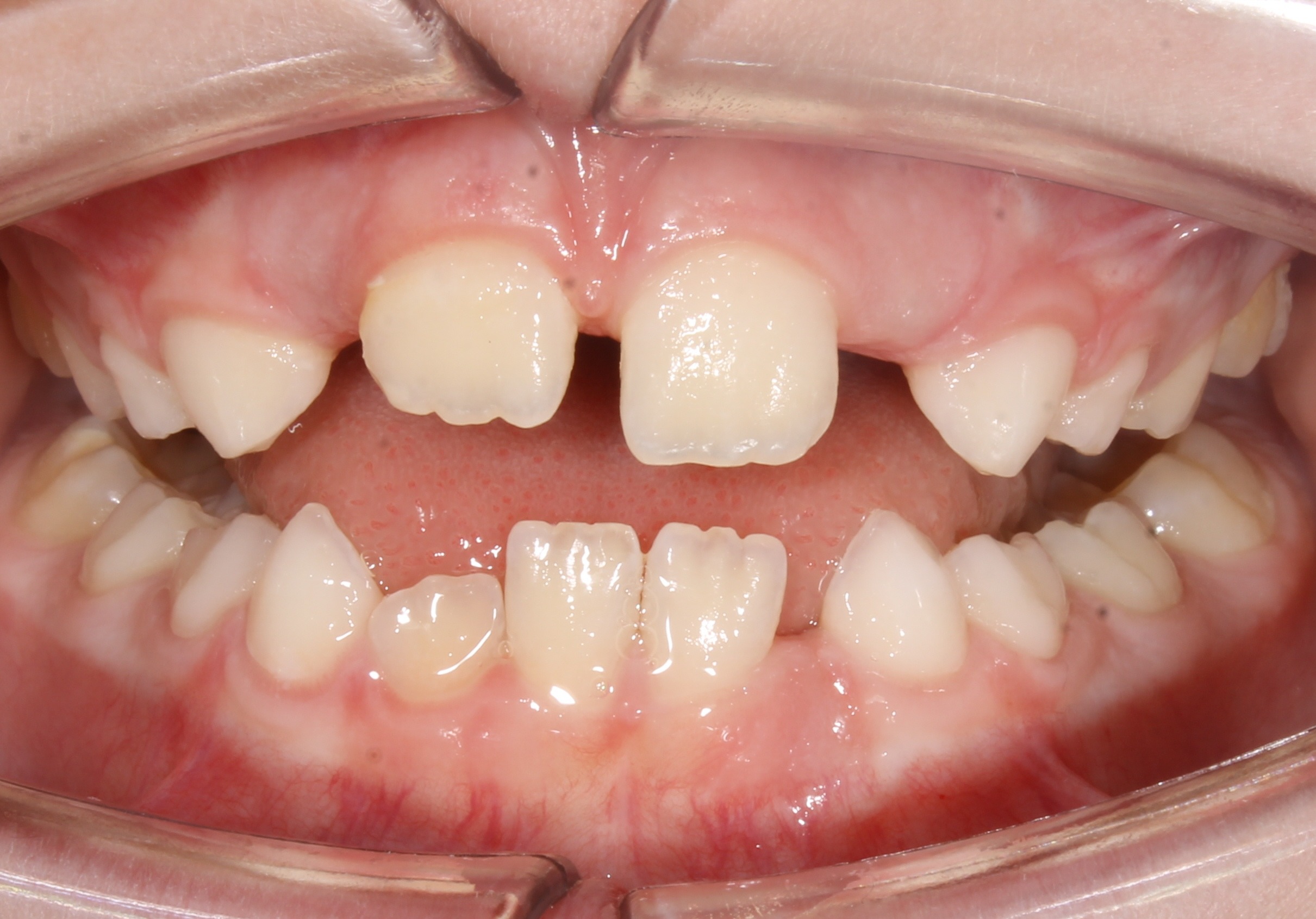 before Image