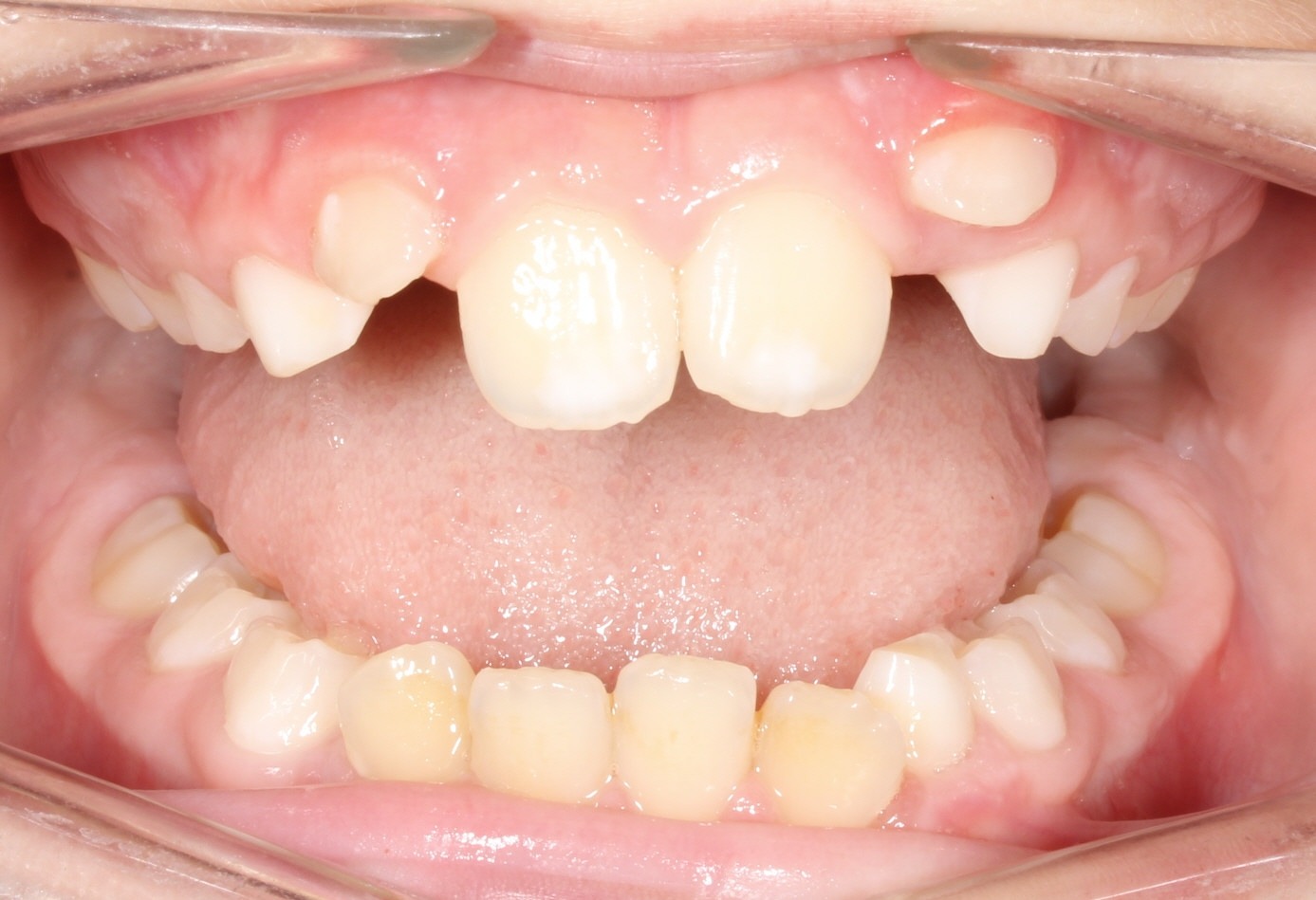 before Image