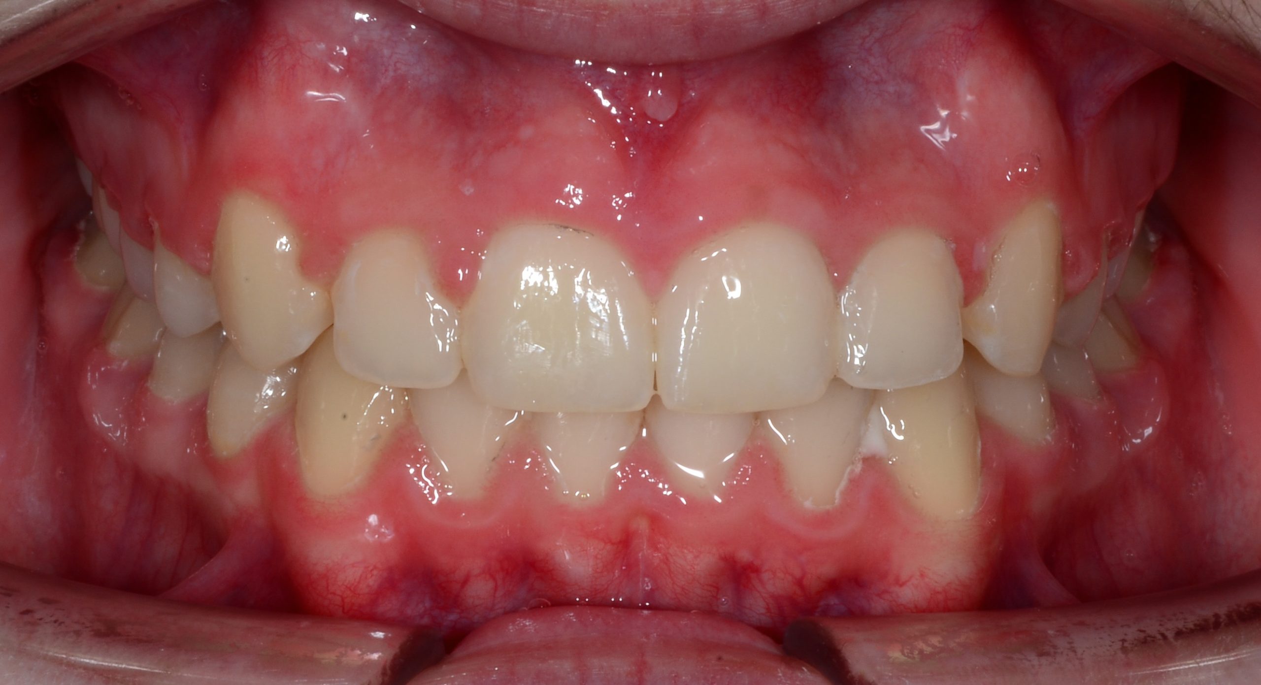after Image