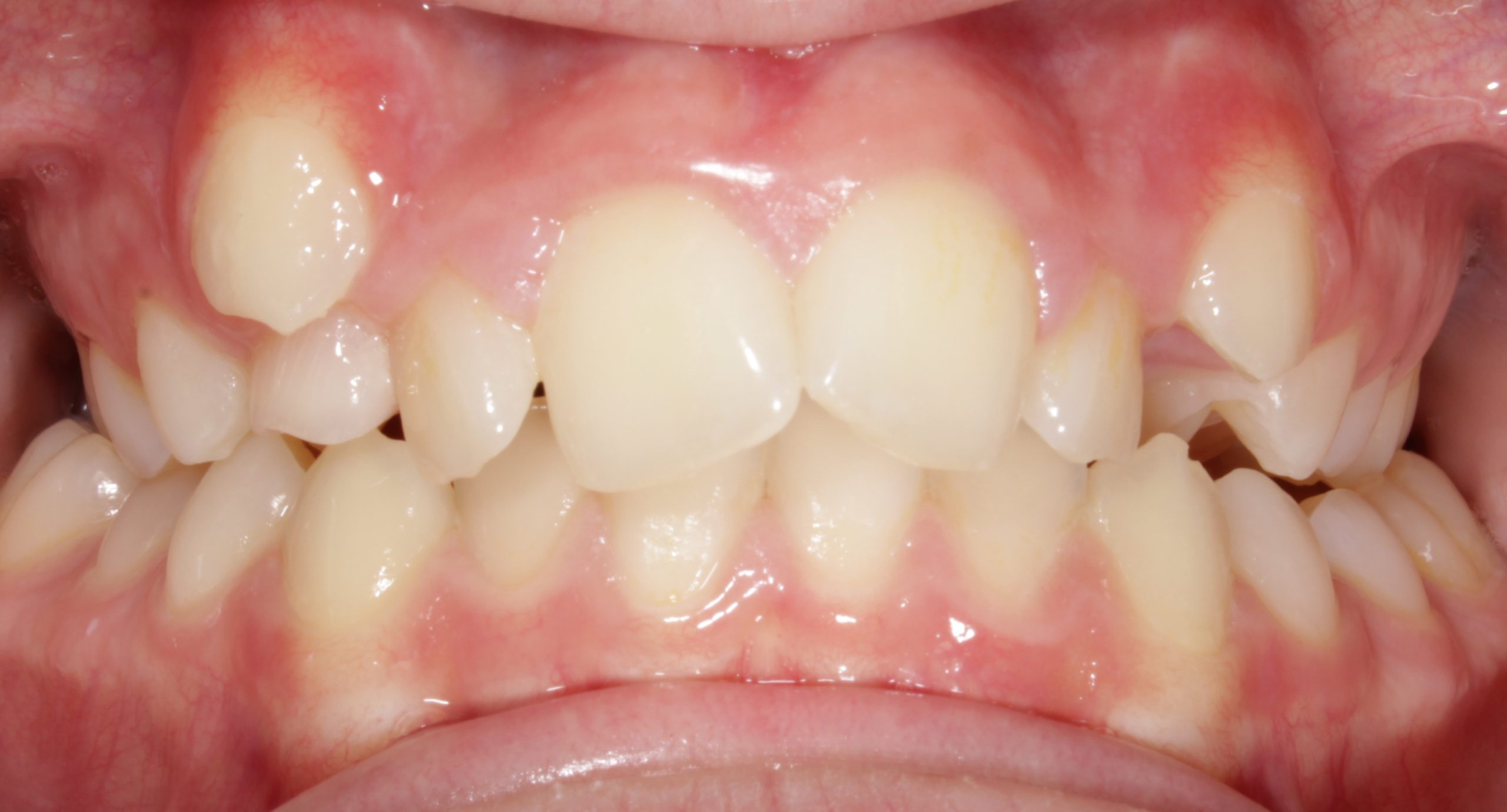 before Image