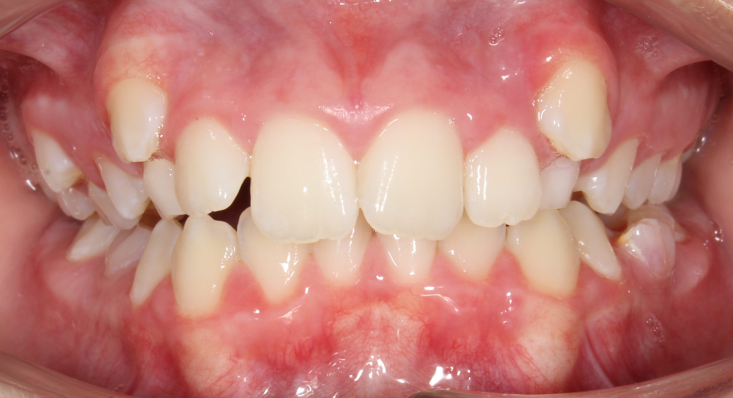 before Image