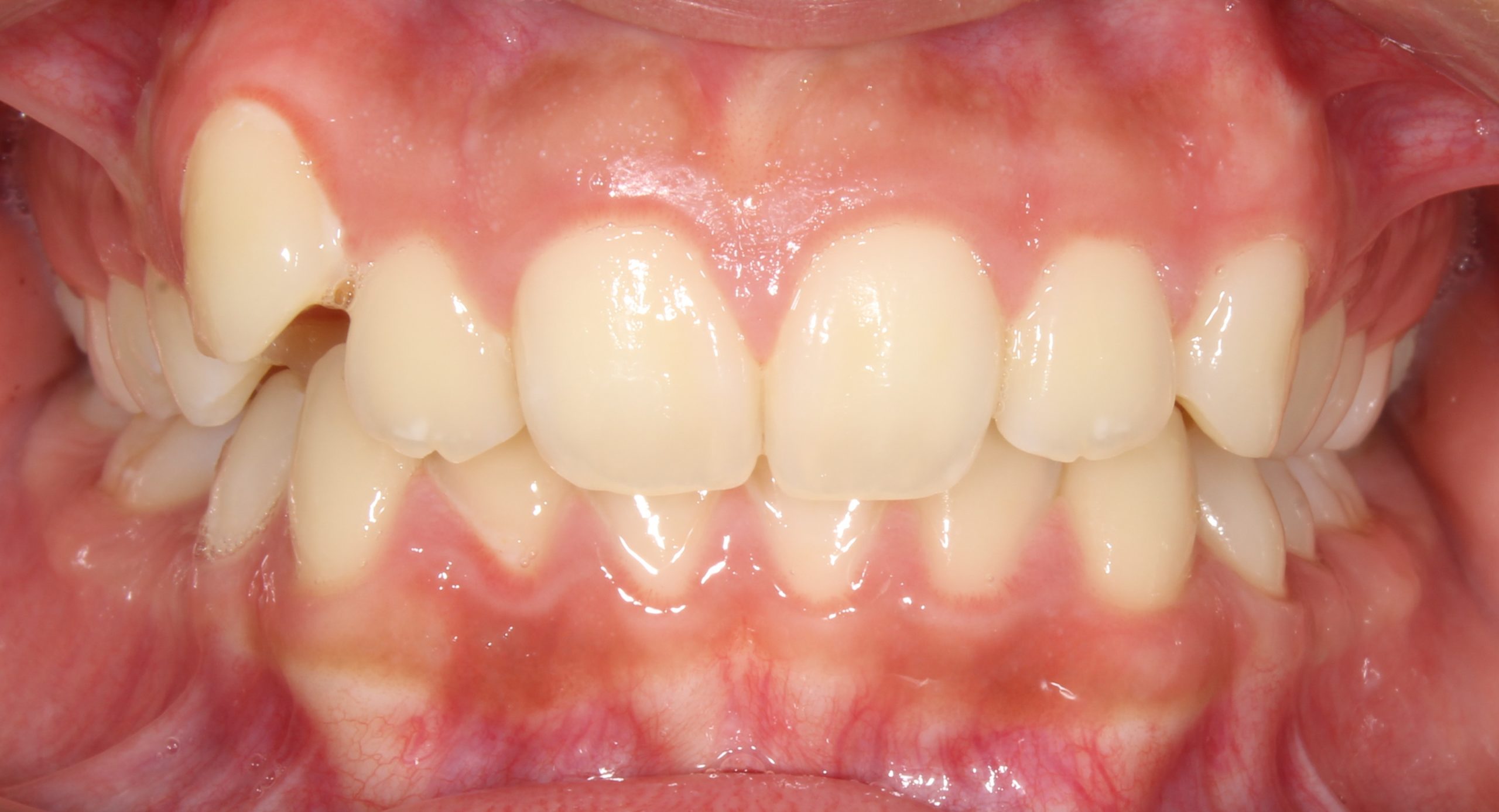 before Image