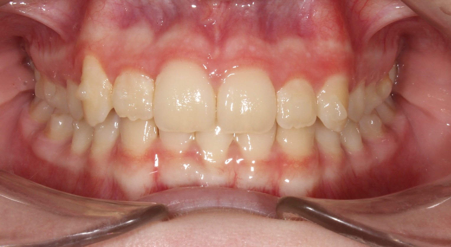 after Image