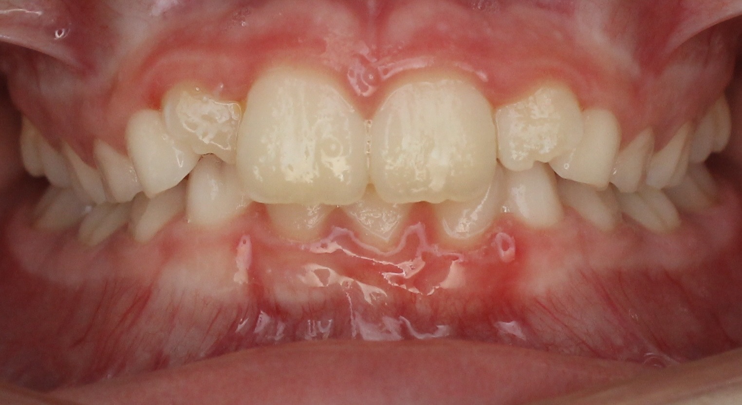 before Image