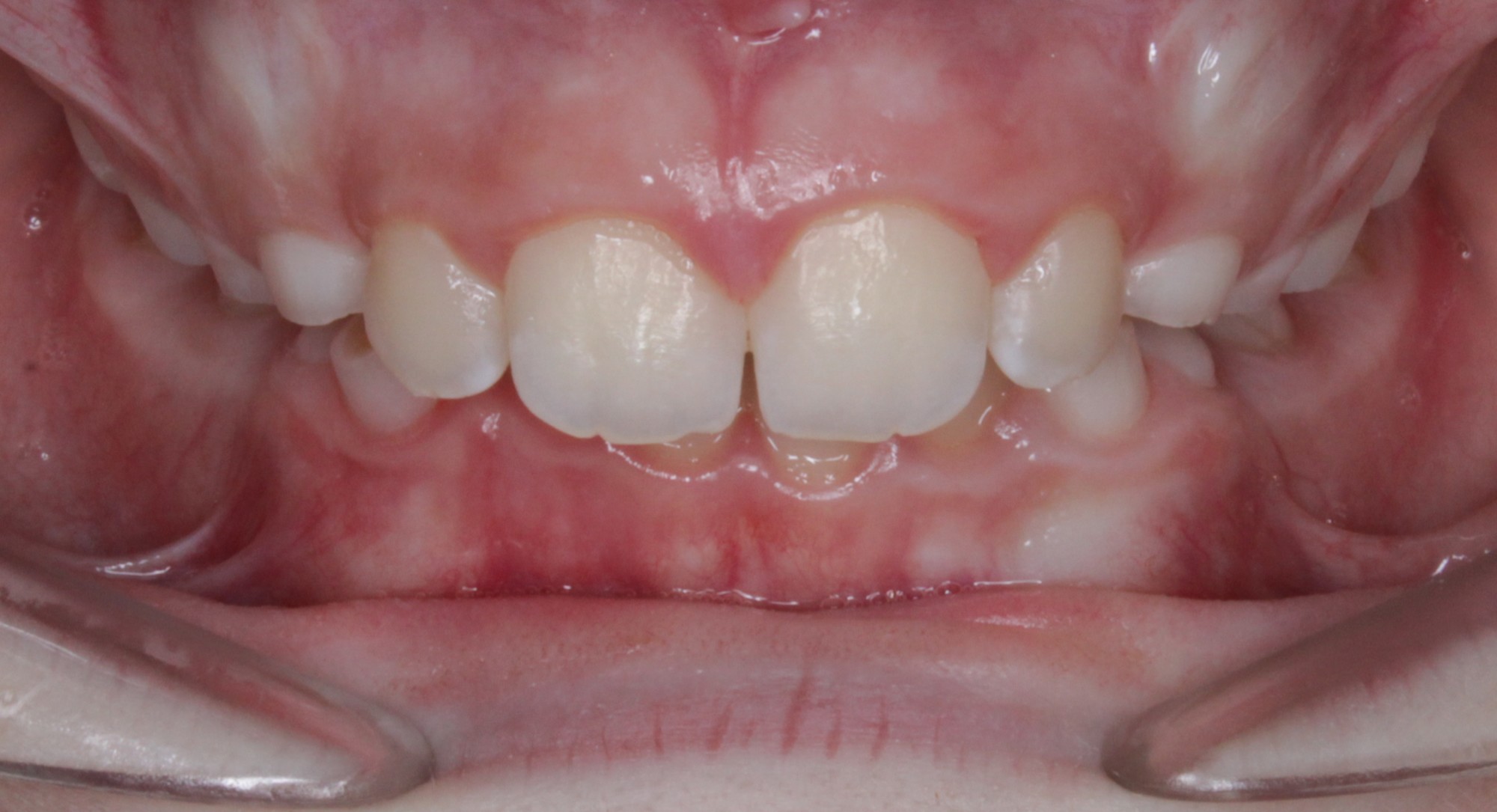before Image