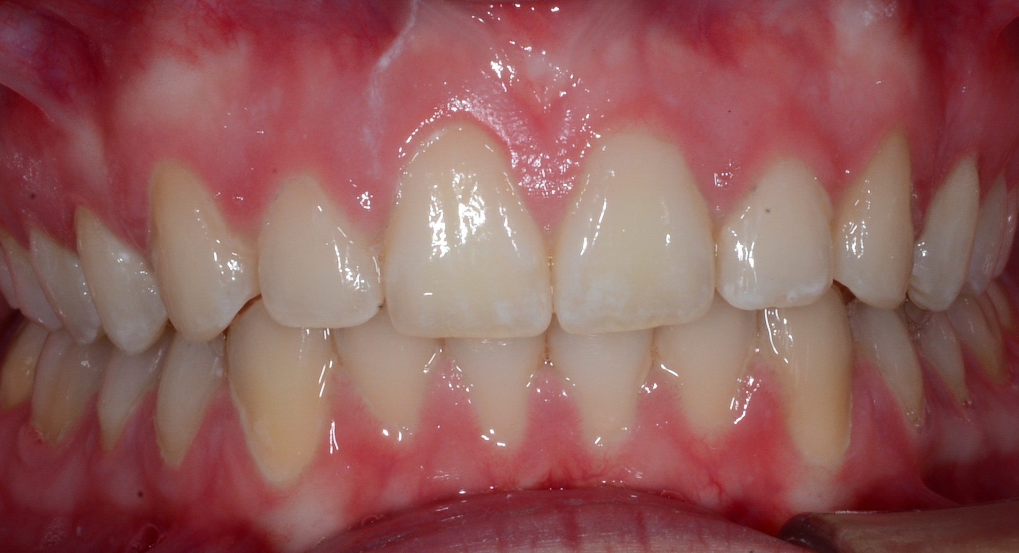 after Image