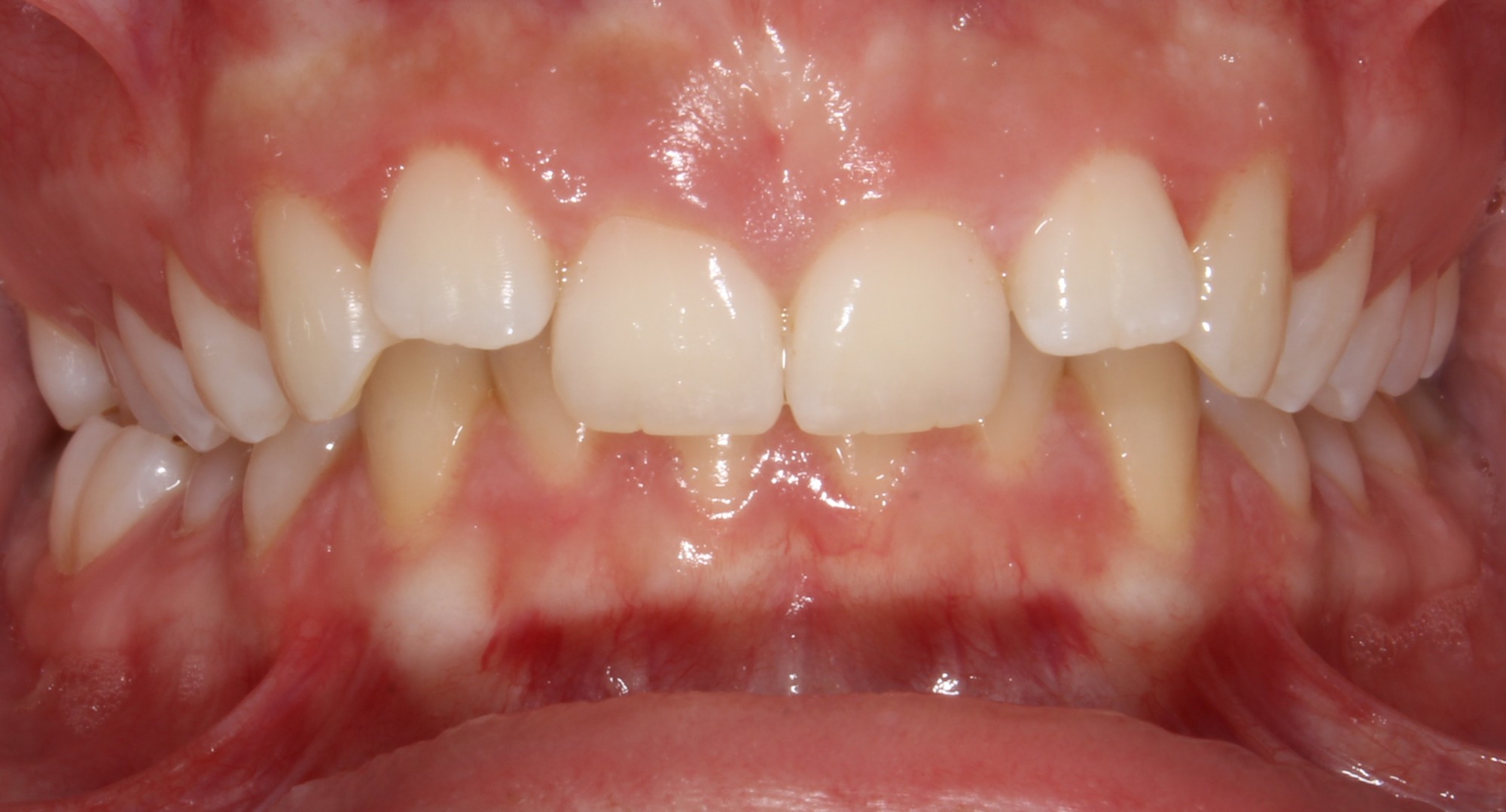 before Image