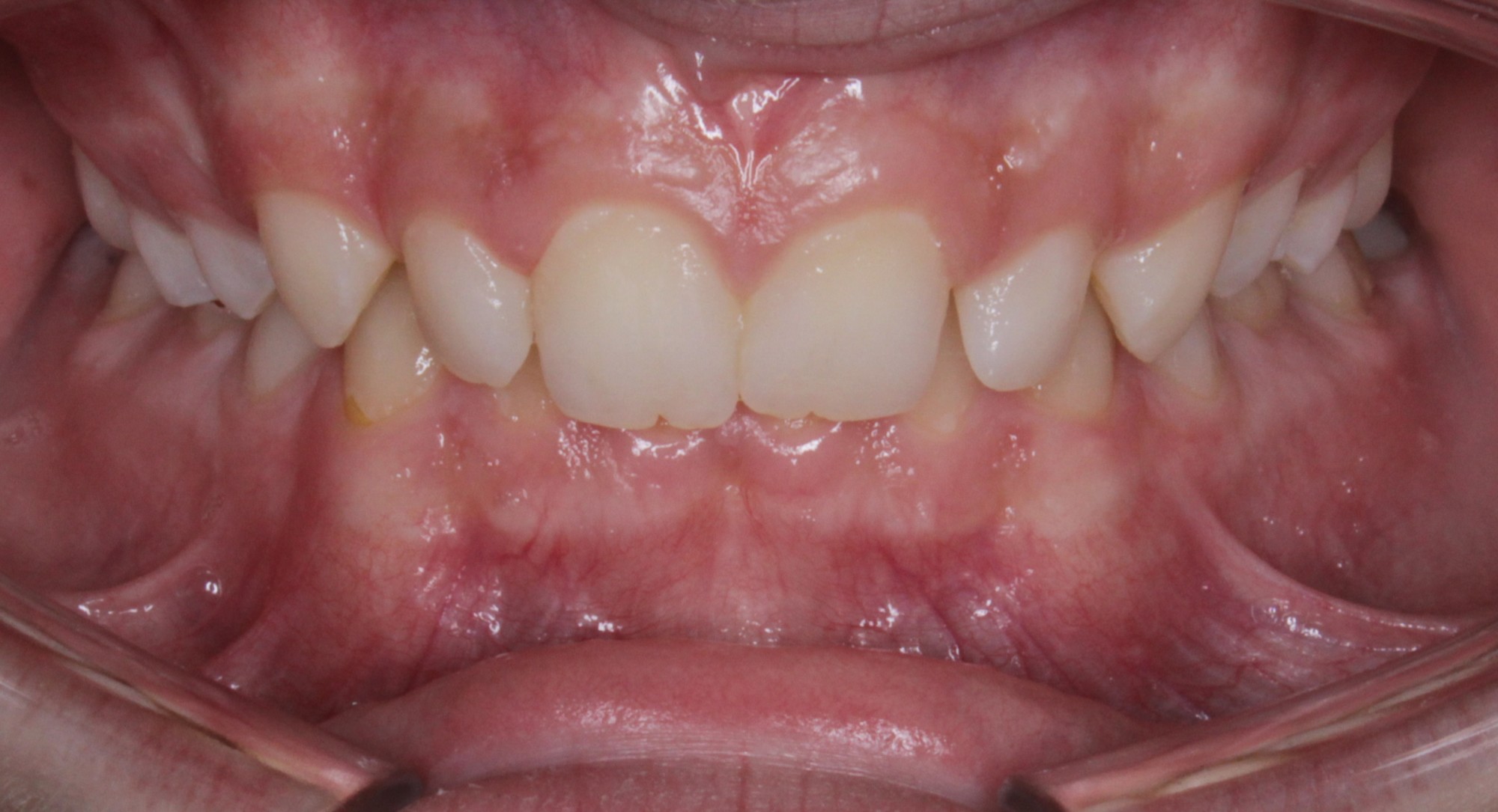 before Image
