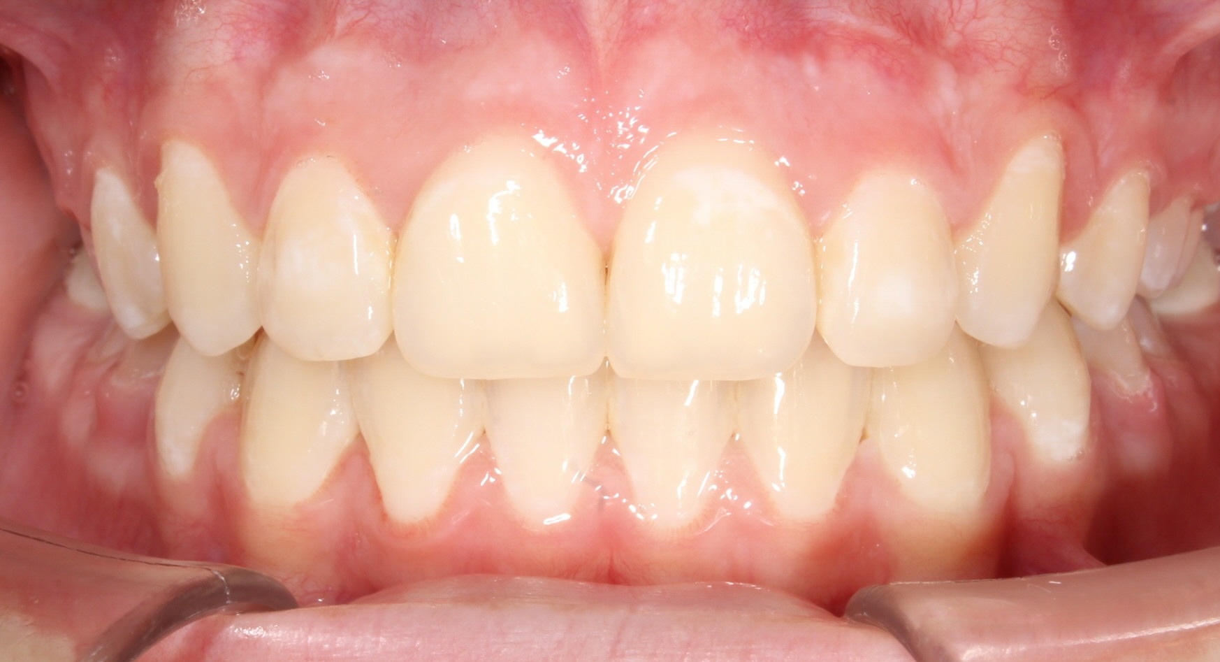 after Image