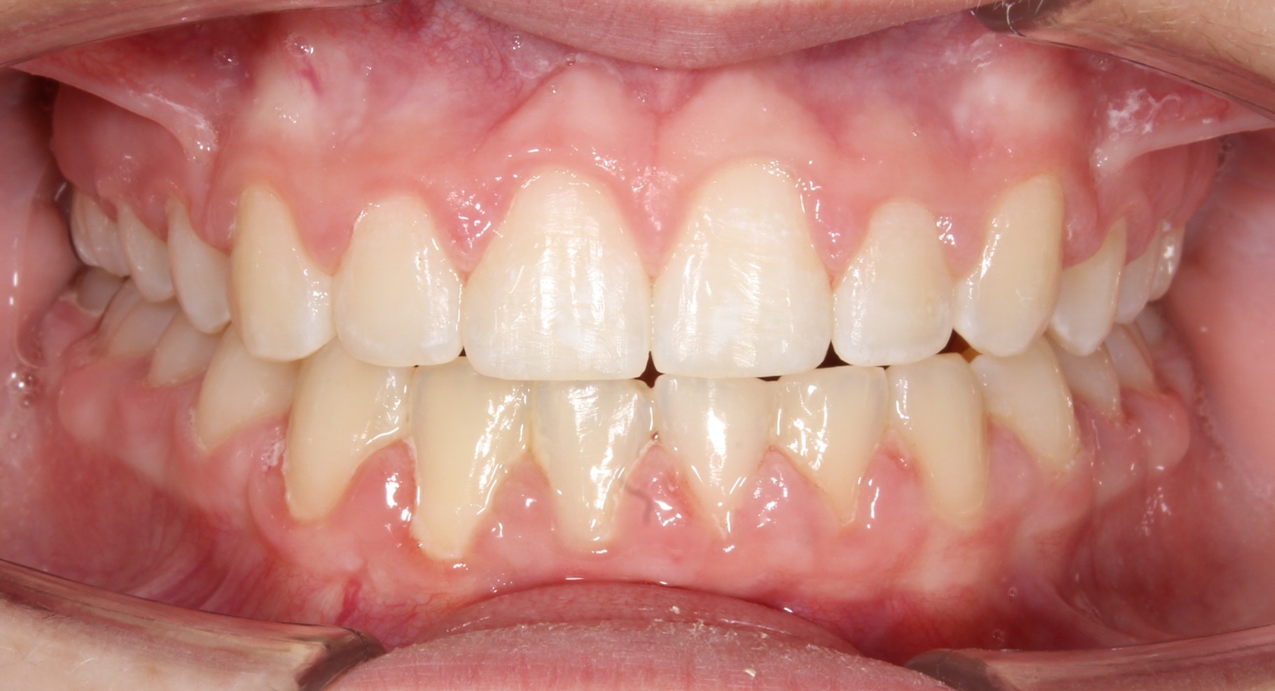 after Image