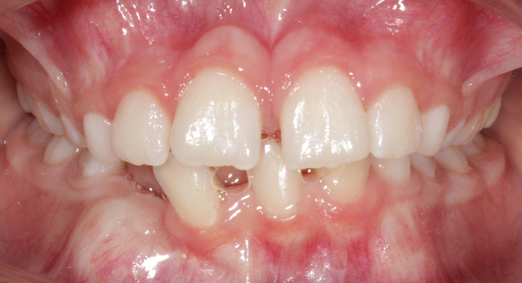 before Image