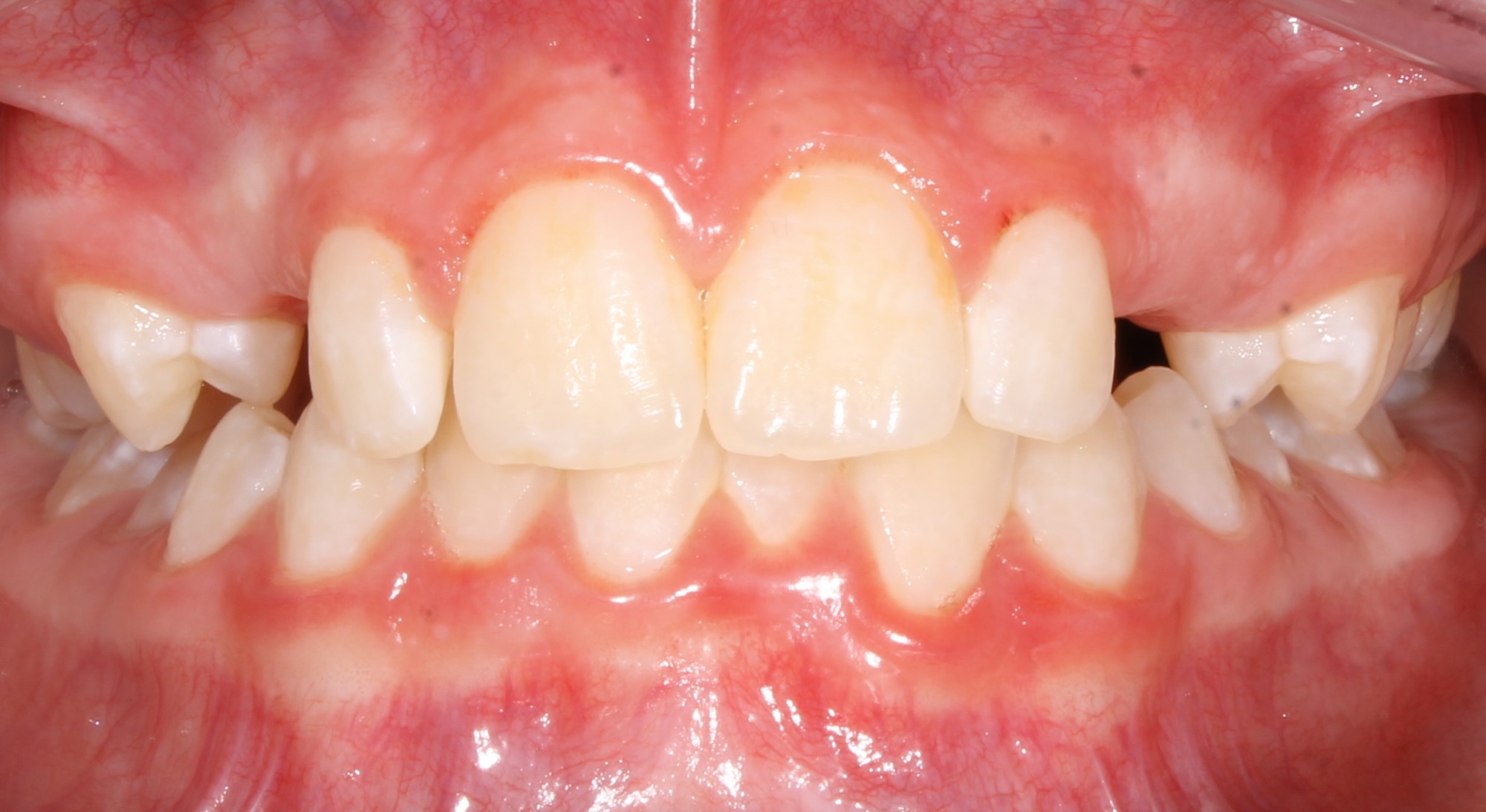 before Image