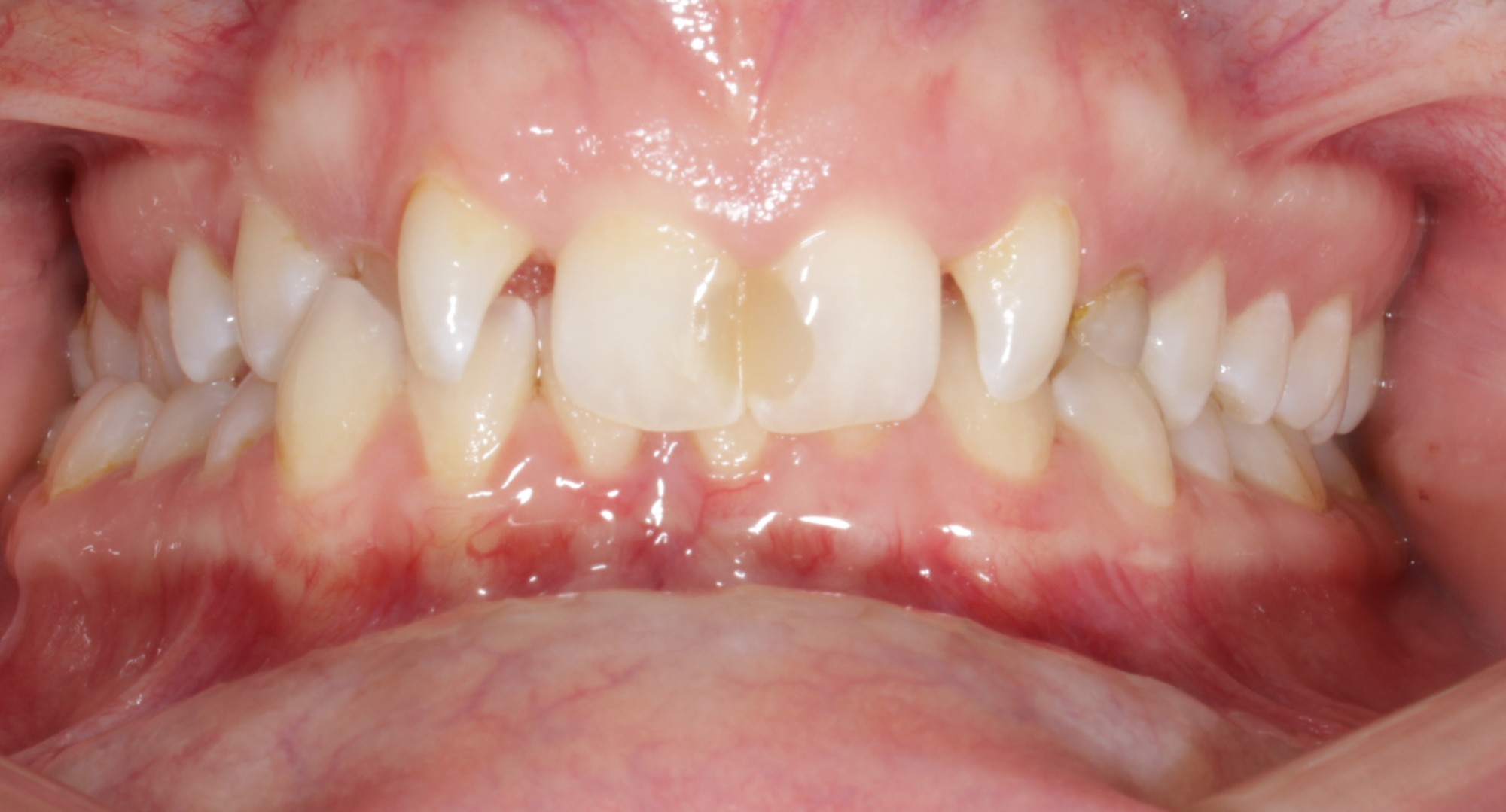 before Image