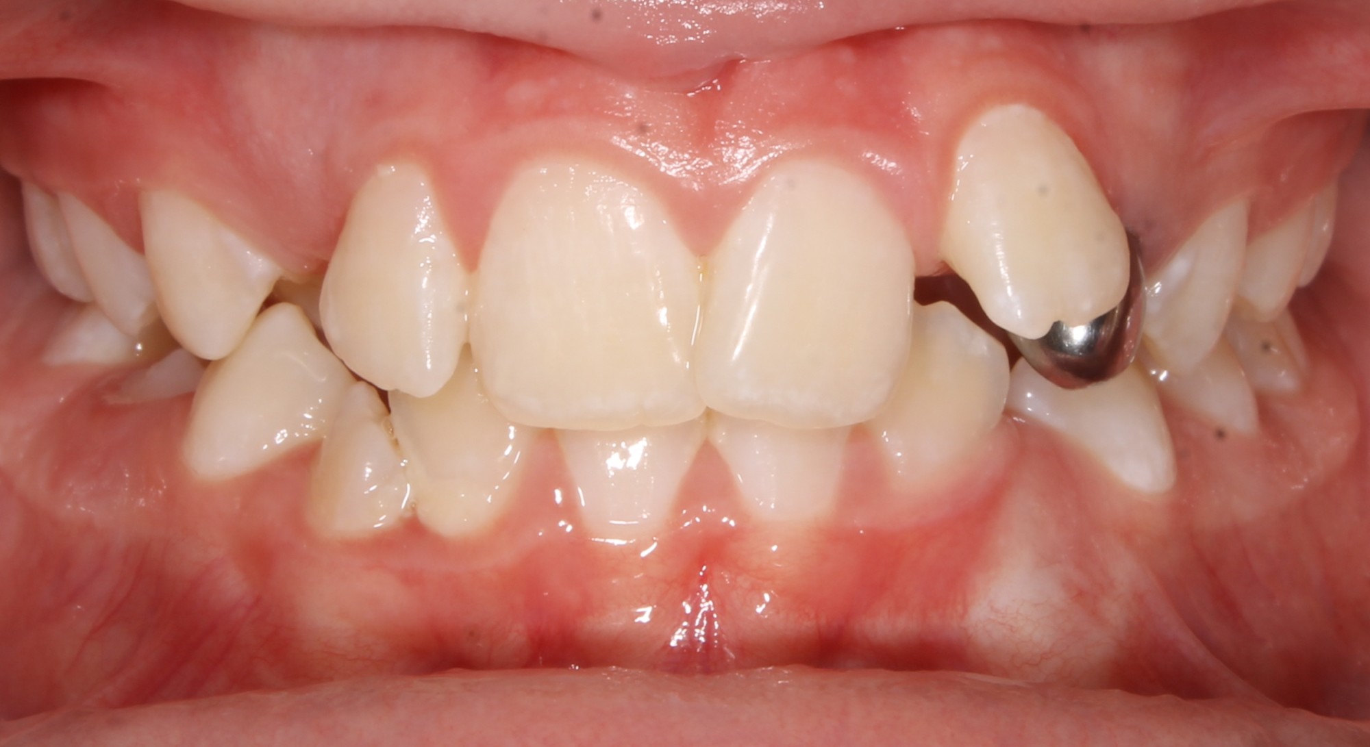 before Image